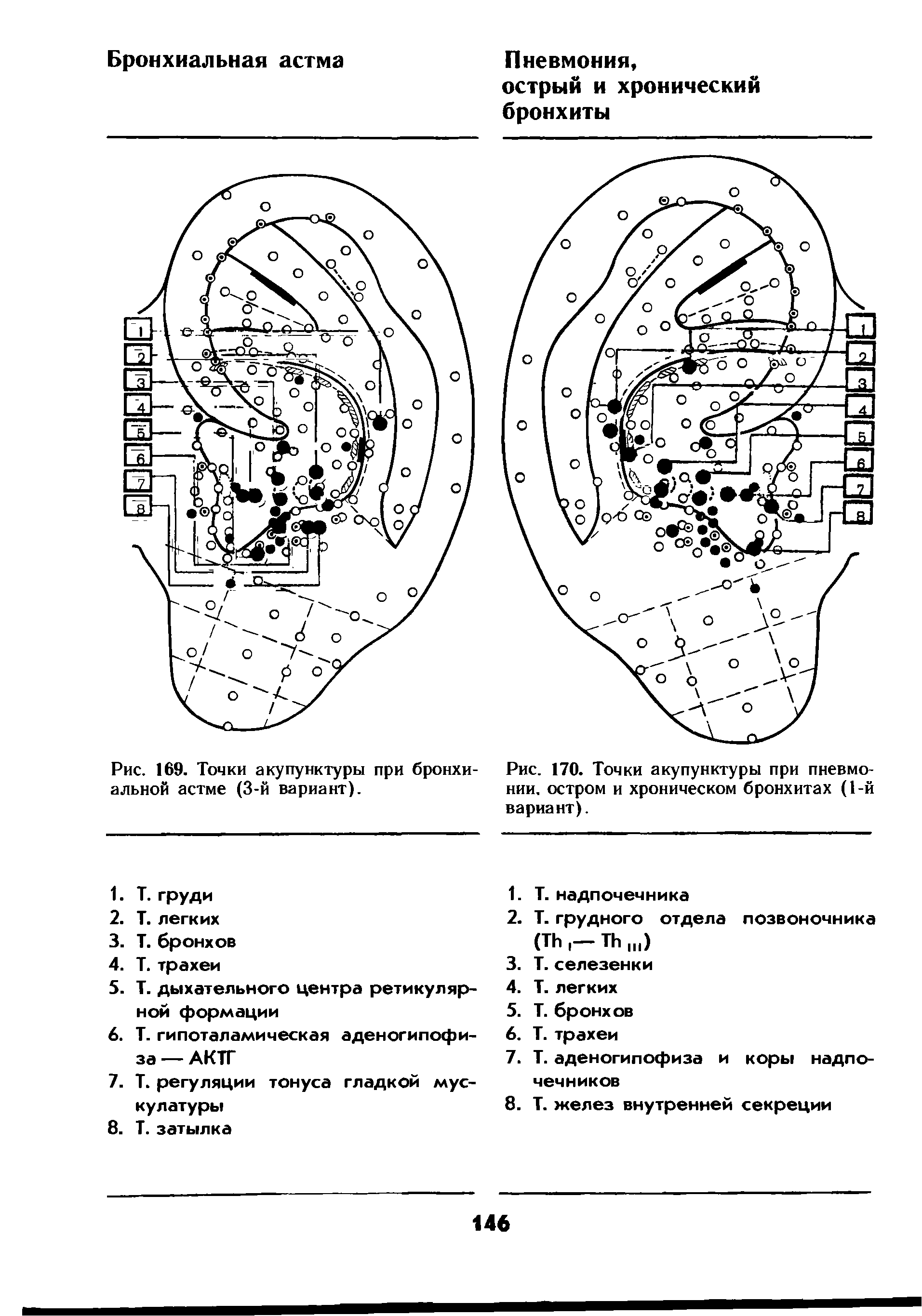 Рис. 170. Точки акупунктуры при пневмонии. остром и хроническом бронхитах (1-й вариант).