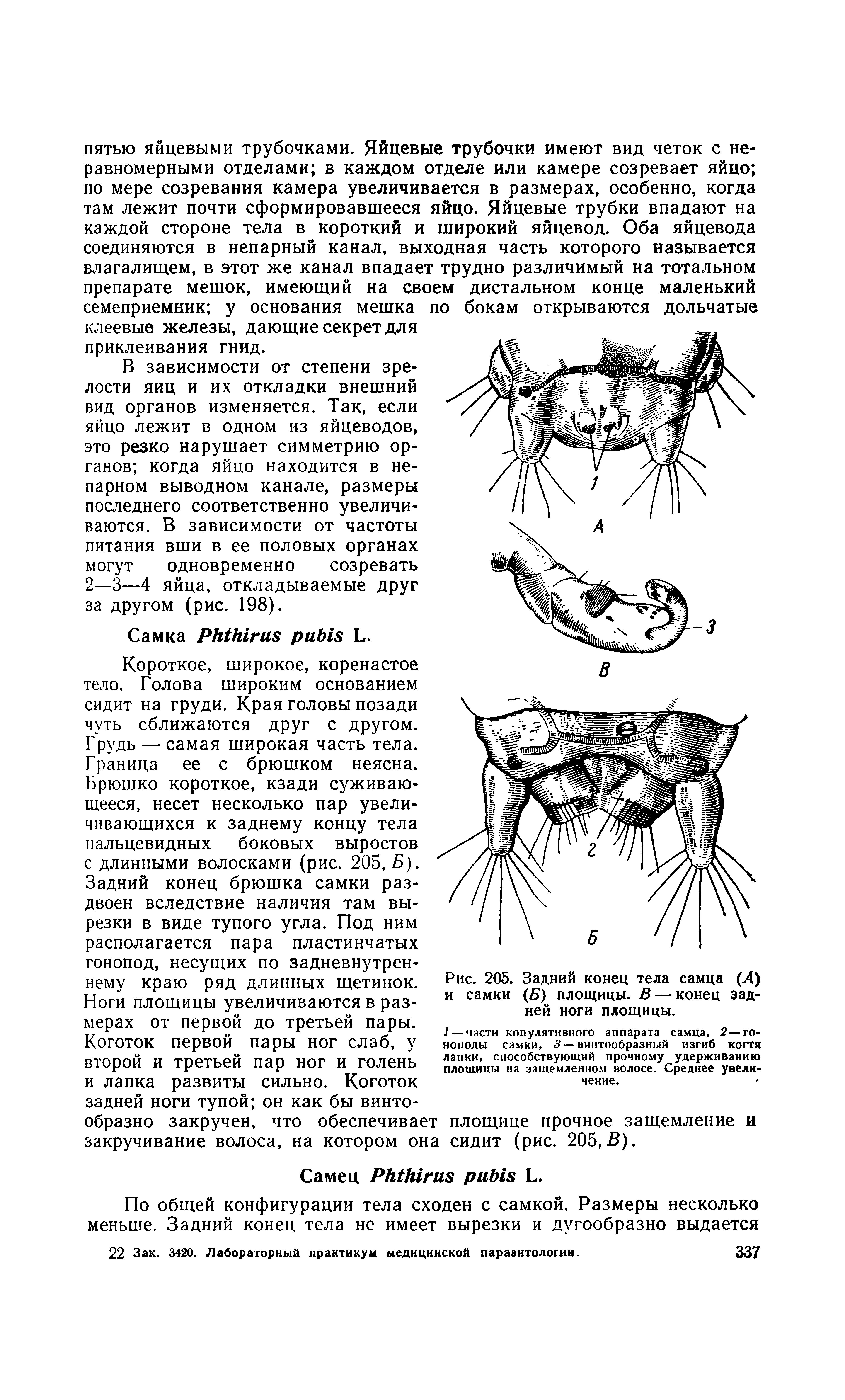 Рис. 205. Задний конец тела самца (Л) и самки (Б) площицы. В — конец задней ноги площицы.