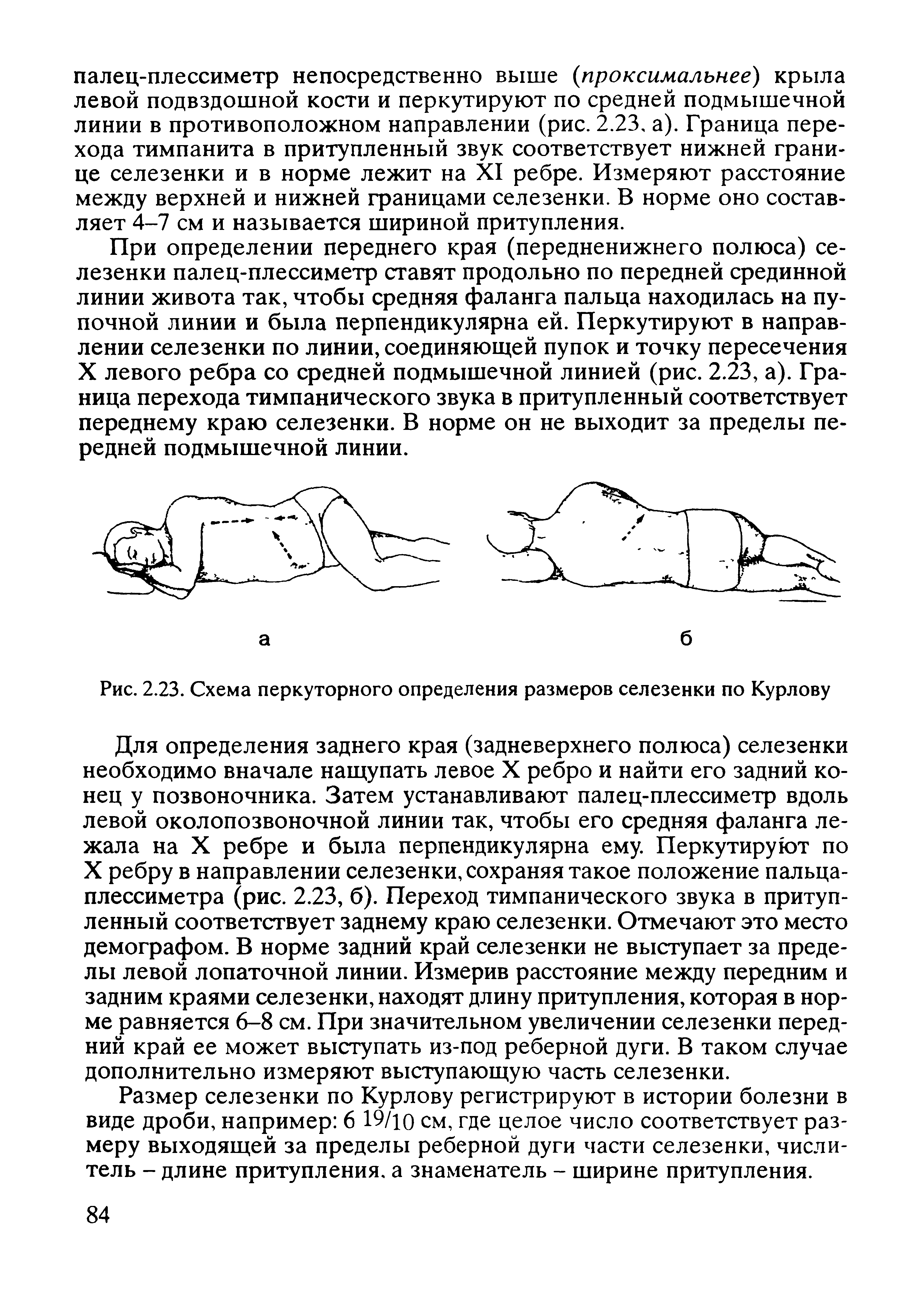 Рис. 2.23. Схема перкуторного определения размеров селезенки по Курлову...