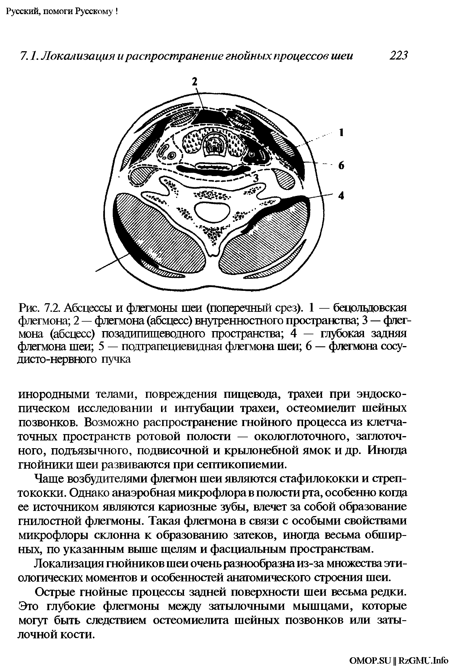 Рис. 7.2. Абсцессы и флегмоны шеи (поперечный срез). 1 — бецолвдовская флегмона 2 — флегмона (абсцесс) внутренностного пространства 3 — флегмона (абсцесс) позадипищеводного пространства 4 — глубокая задняя флегмона шеи 5 — подграпециевцдная флегмона шеи 6 — флегмона сосудисто-нервного пучка...