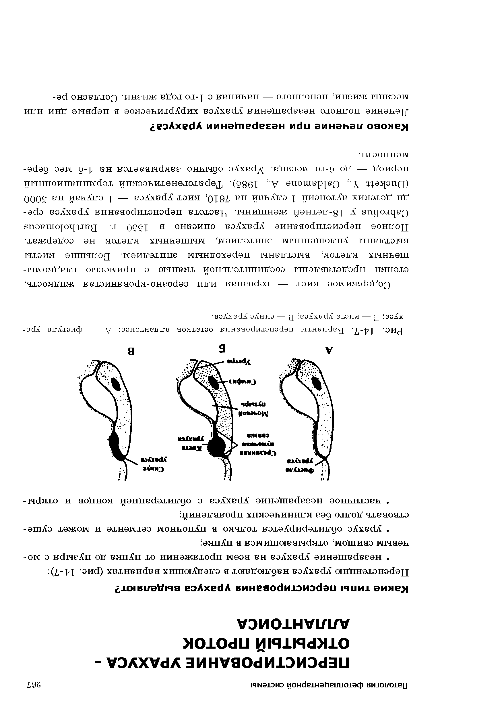 Рис. 14-7. Варианты персистирования остатков аллантоиса А — фистула урахуса Б — киста урахуса В — синус урахуса.