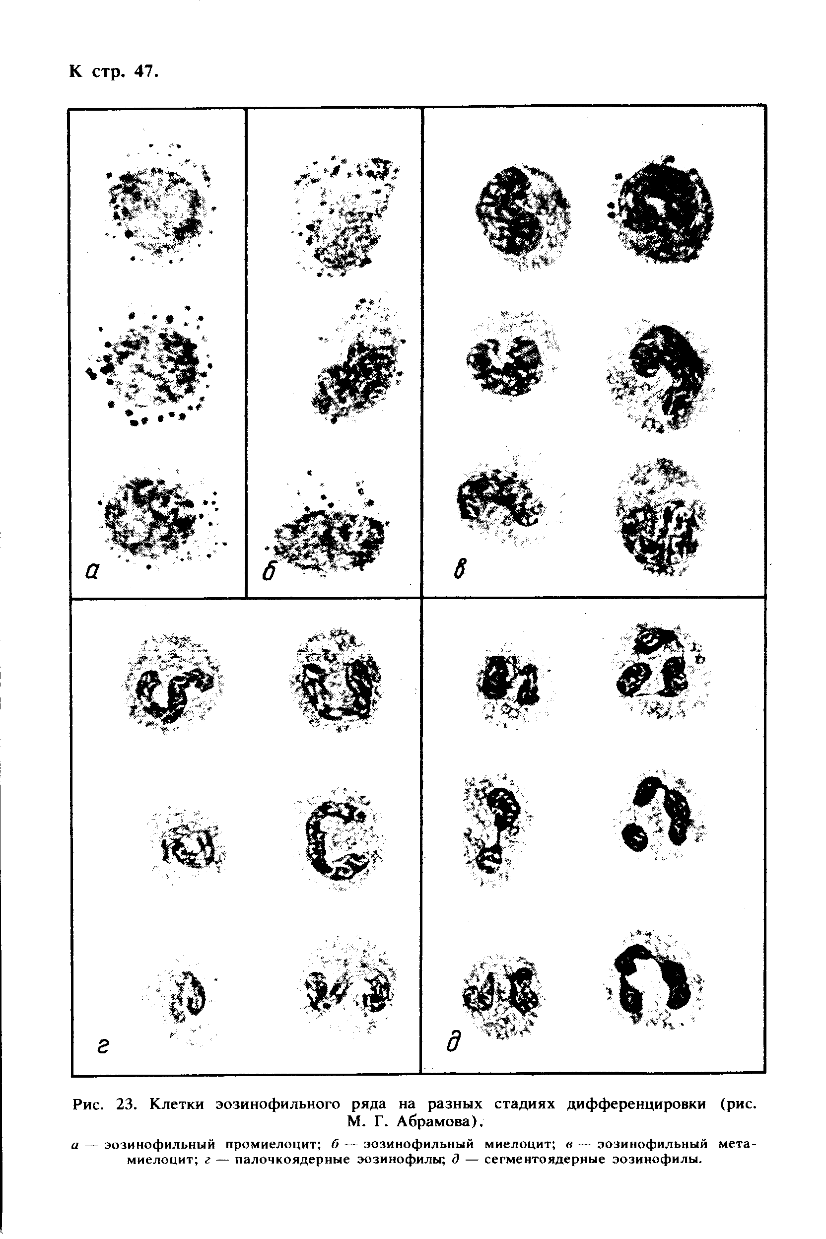 Рис. 23. Клетки эозинофильного ряда на разных стадиях дифференцировки (рис. М. Г. Абрамова).
