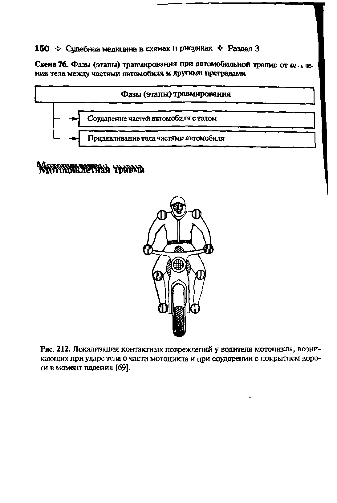 Рис. 212. Локализация контактных повреждений у водителя мотоцикла, возникающих при ударе тела о части мотоцикла и при соударении с покрытием дороги в момент падения [69].