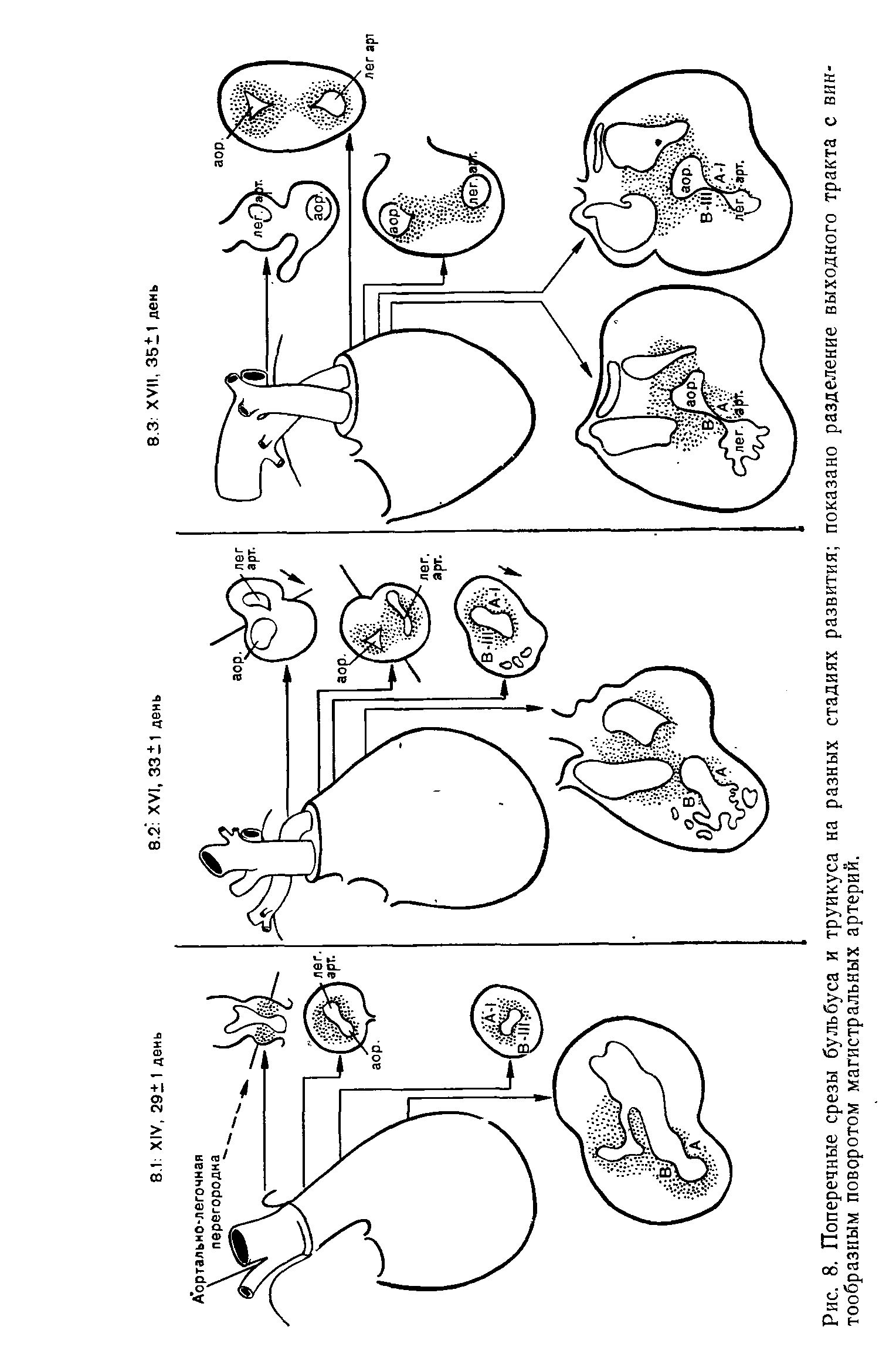 Рис. 8. Поперечные срезы бульбуса и труикуса на разных стадиях развития показано разделение выходного тракта с винтообразным поворотом магистральных артерий.