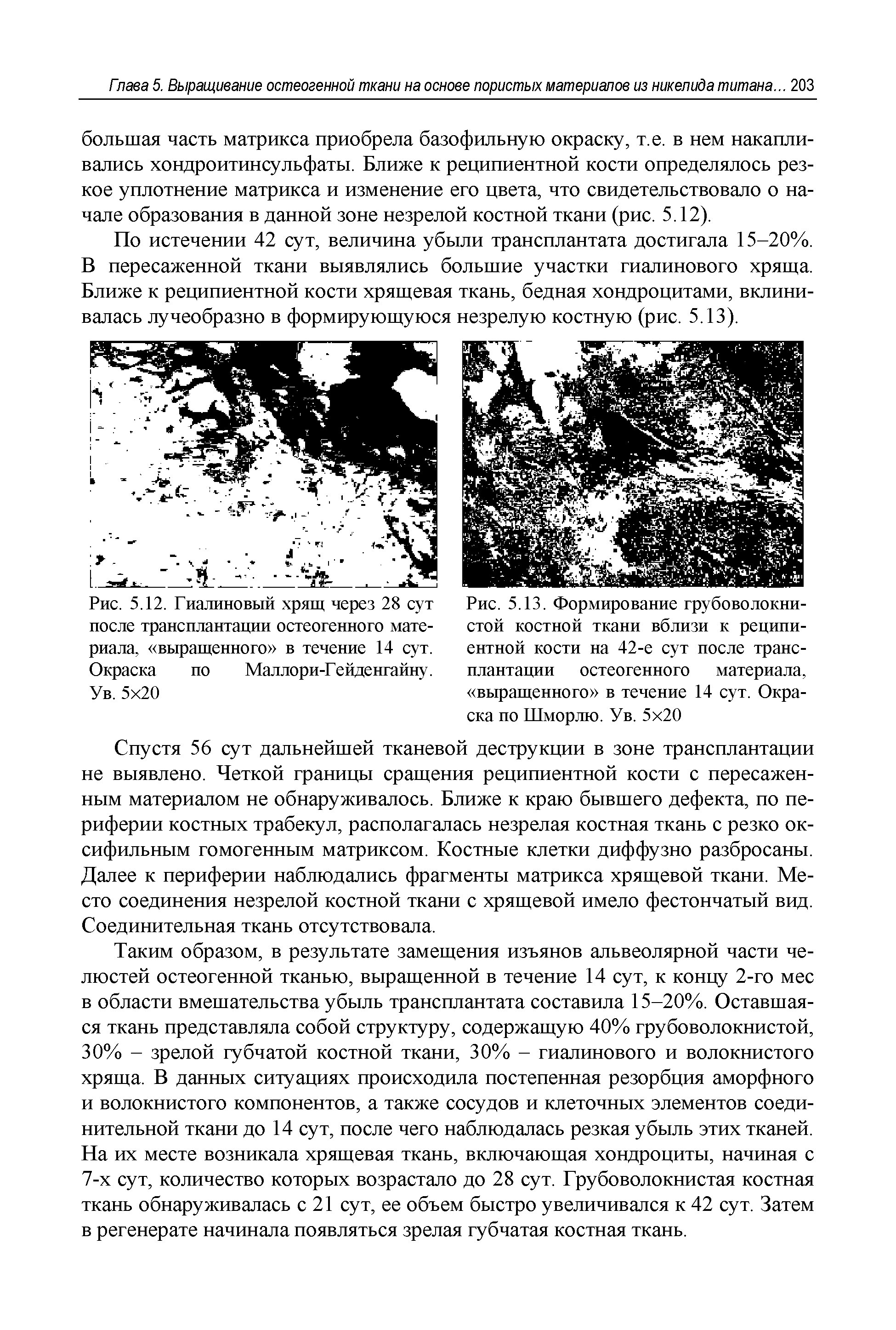 Рис. 5.13. Формирование грубоволокнистой костной ткани вблизи к реципиентной кости на 42-е сут после трансплантации остеогенного материала, выращенного в течение 14 сут. Окраска по Шморлю. Ув. 5 20...