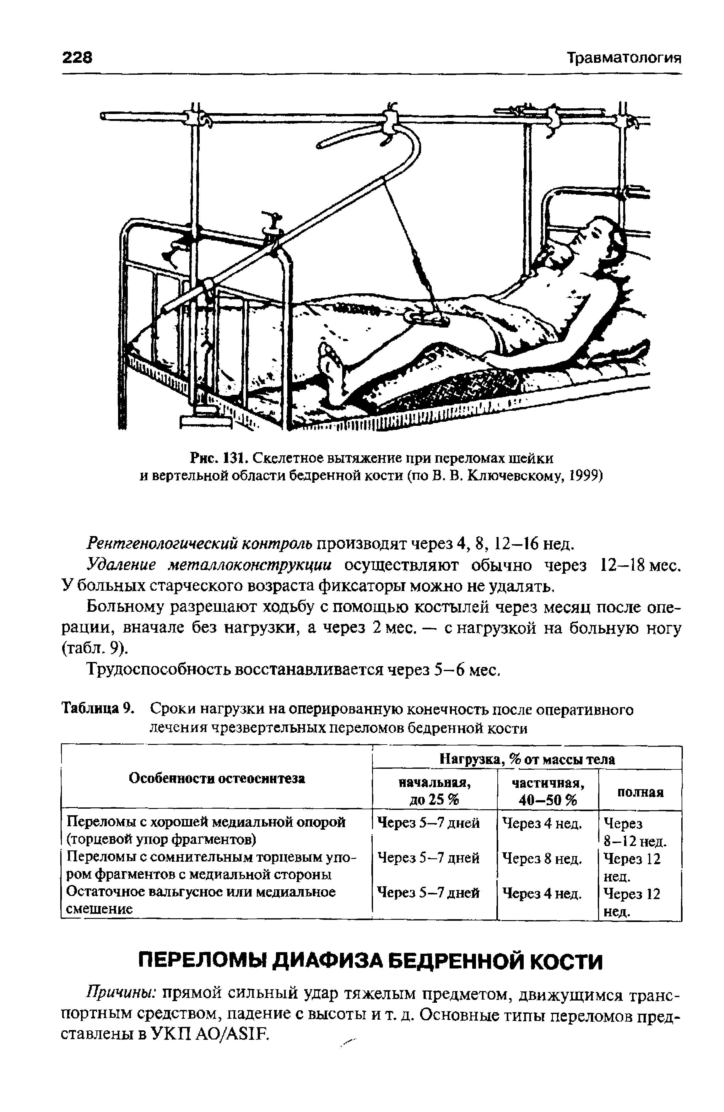 Таблица 9. Сроки нагрузки на оперированную конечность после оперативного лечения чрезвертельных переломов бедренной кости...