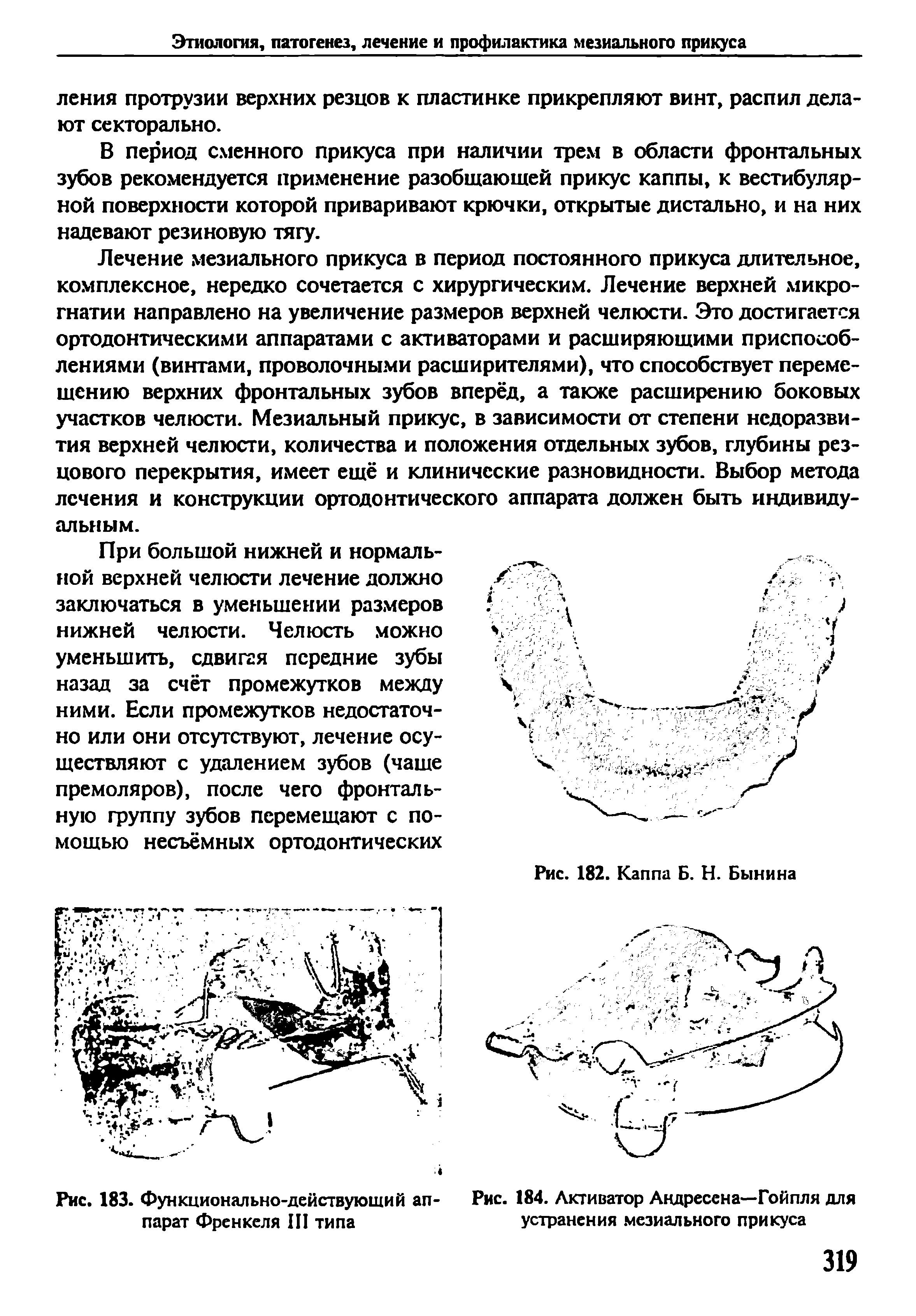 Рис. 184. Активатор Андресена—Гойпля для устранения мезиального прикуса...