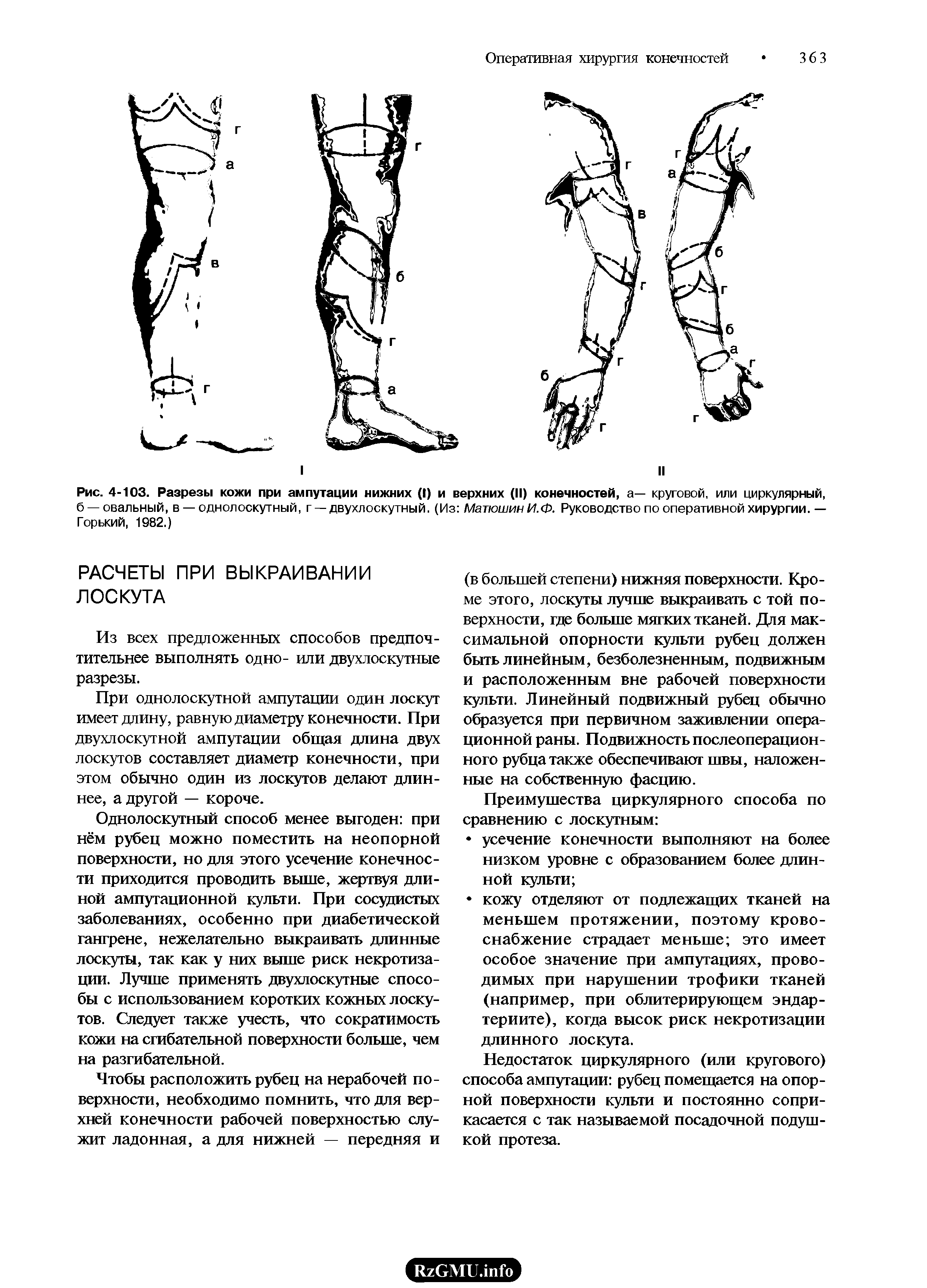 Рис. 4-103. Разрезы кожи при ампутации нижних (I) и верхних (II) конечностей, а— круговой, или циркулярный,...