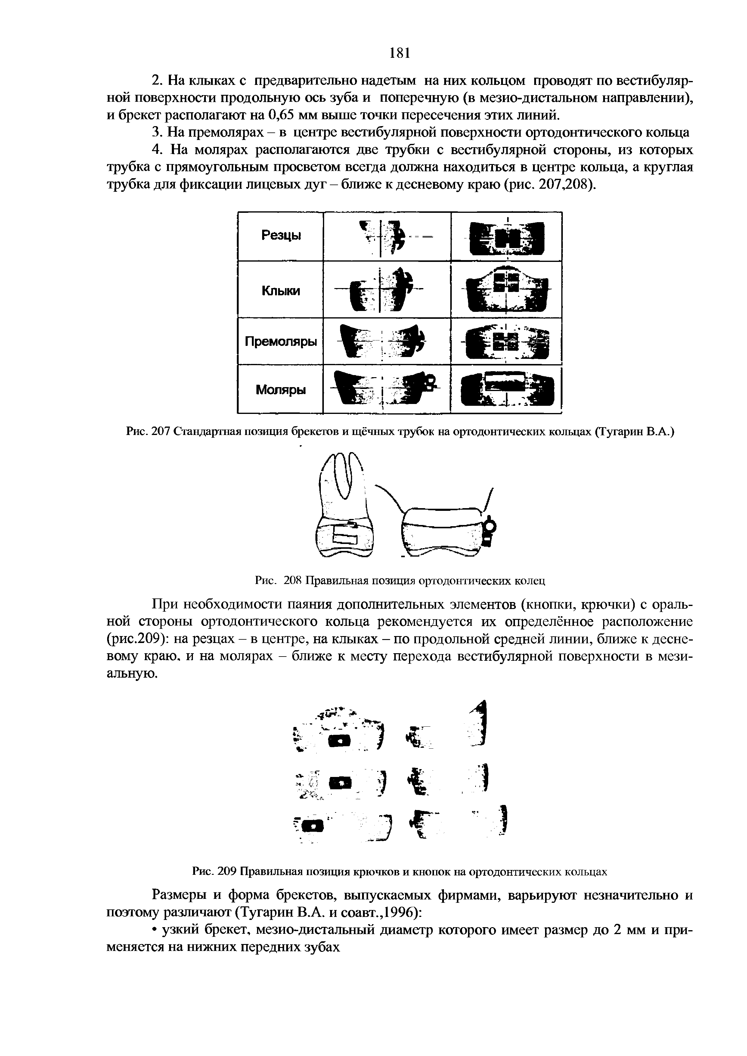 Рис. 207 Стандартная позиция брекетов и щёчных трубок на ортодонтических кольцах (Тугарин В.А.)...