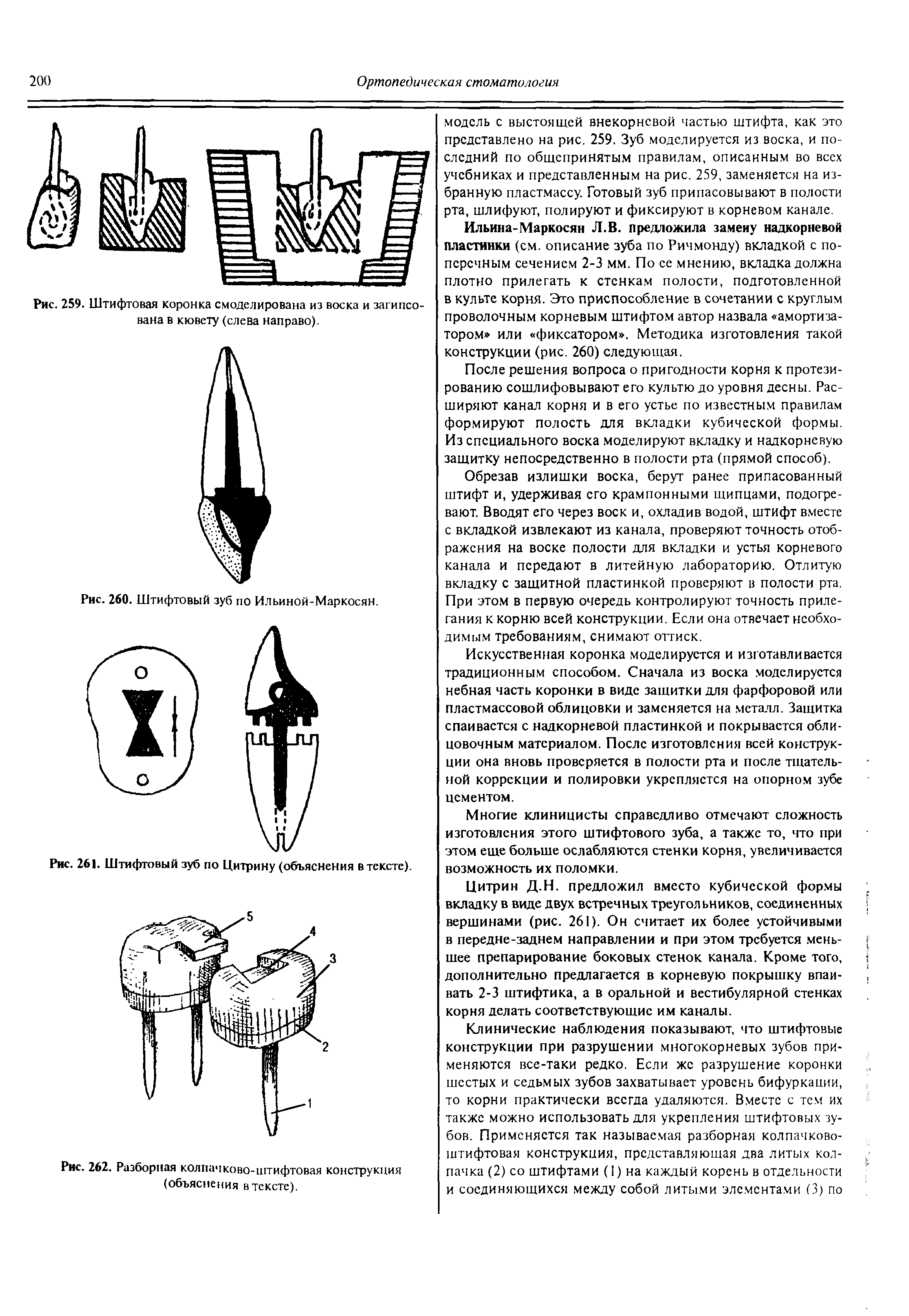 Рис. 262. Разборная колпачково-штифтовая конструкция (объяснения в тексте).