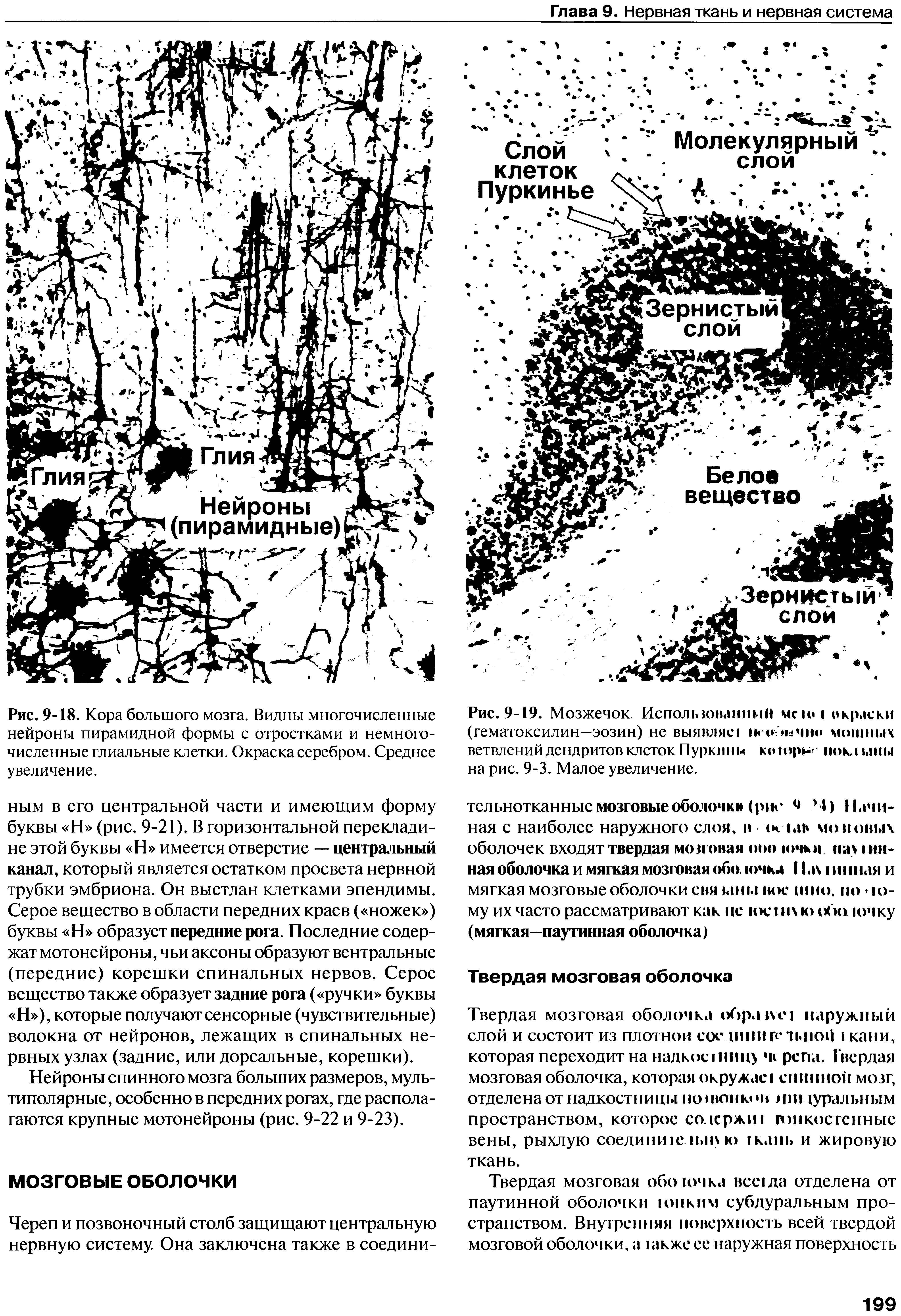 Рис. 9-18. Кора большого мозга. Видны многочисленные нейроны пирамидной формы с отростками и немногочисленные глиальные клетки. Окраска серебром. Среднее увеличение.