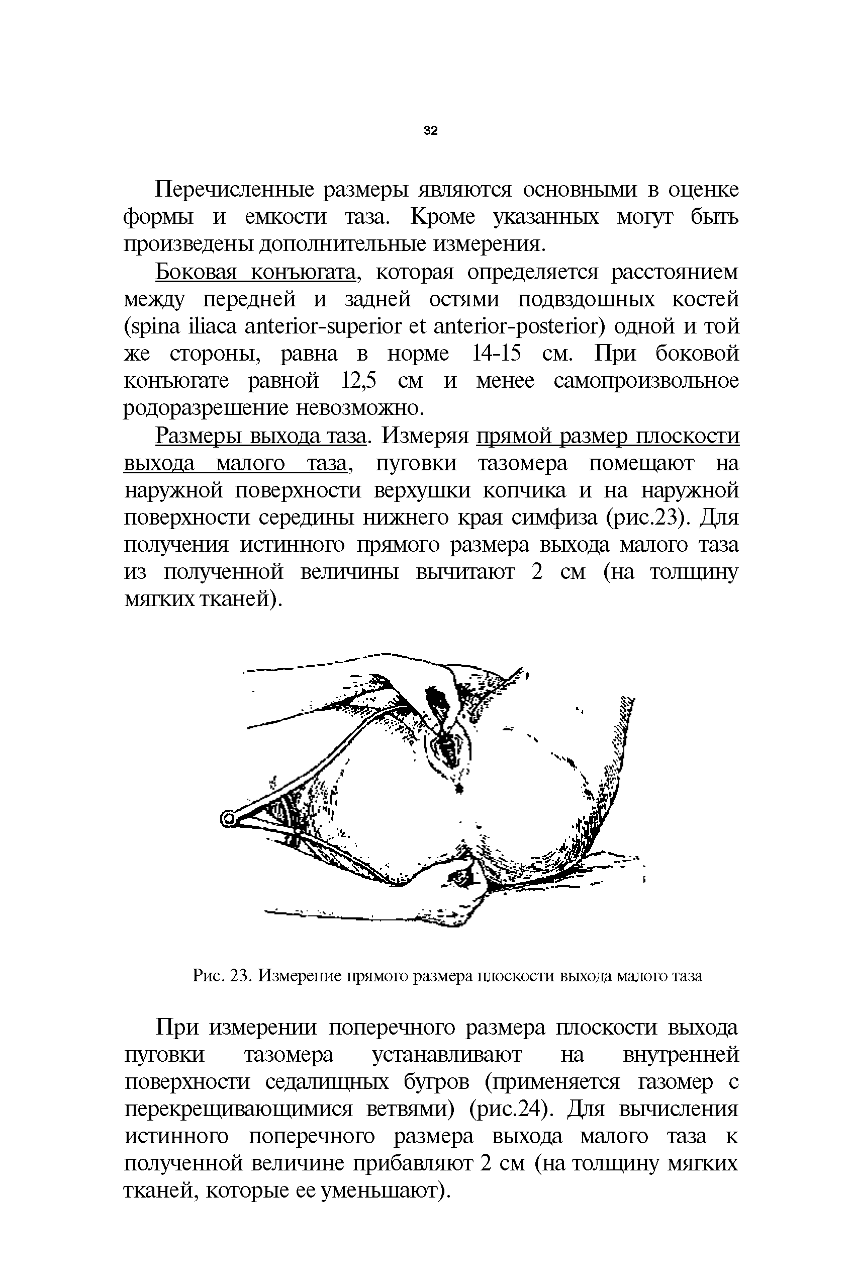 Рис. 23. Измерение прямого размера плоскости выхода малого таза...