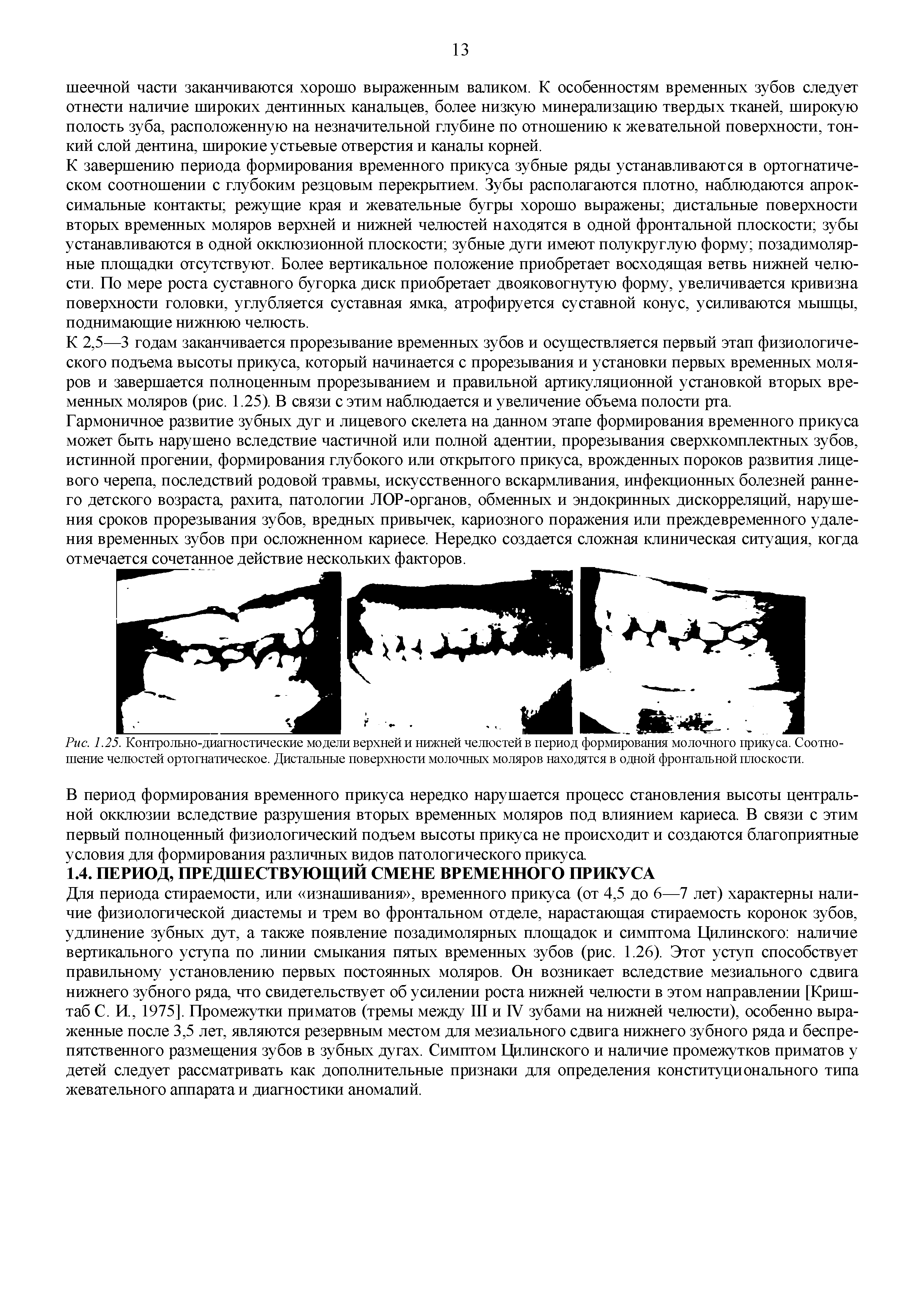 Рис. 1.25. Контрольно-диагностические модели верхней и нижней челюстей в период формирования молочного прикуса. Соотношение челюстей ортогнатическое. Дистальные поверхности молочных моляров находятся в одной фронтальной плоскости.