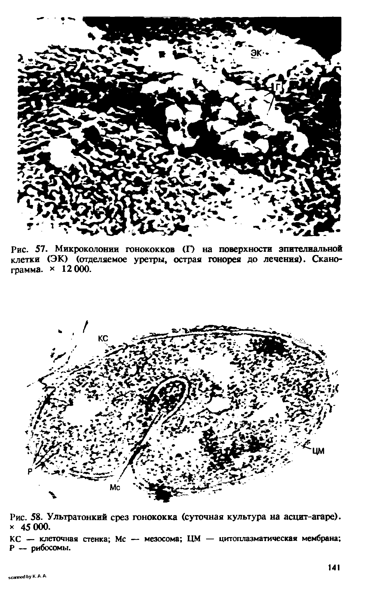 Рис. 58. Ультратонкий срез гонококка (суточная культура на асцит-агаре). х 45 000.