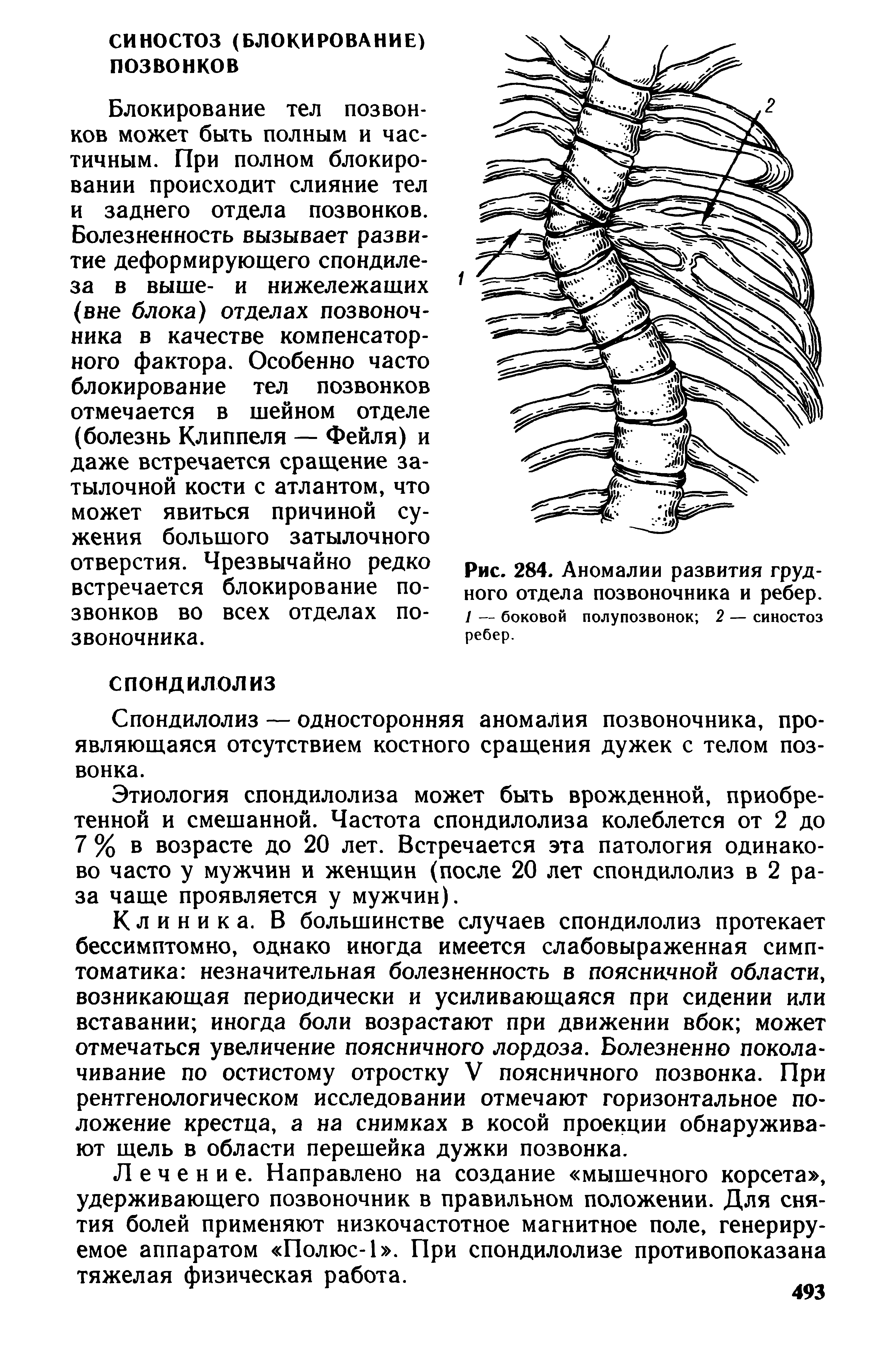 Рис. 284. Аномалии развития грудного отдела позвоночника и ребер.