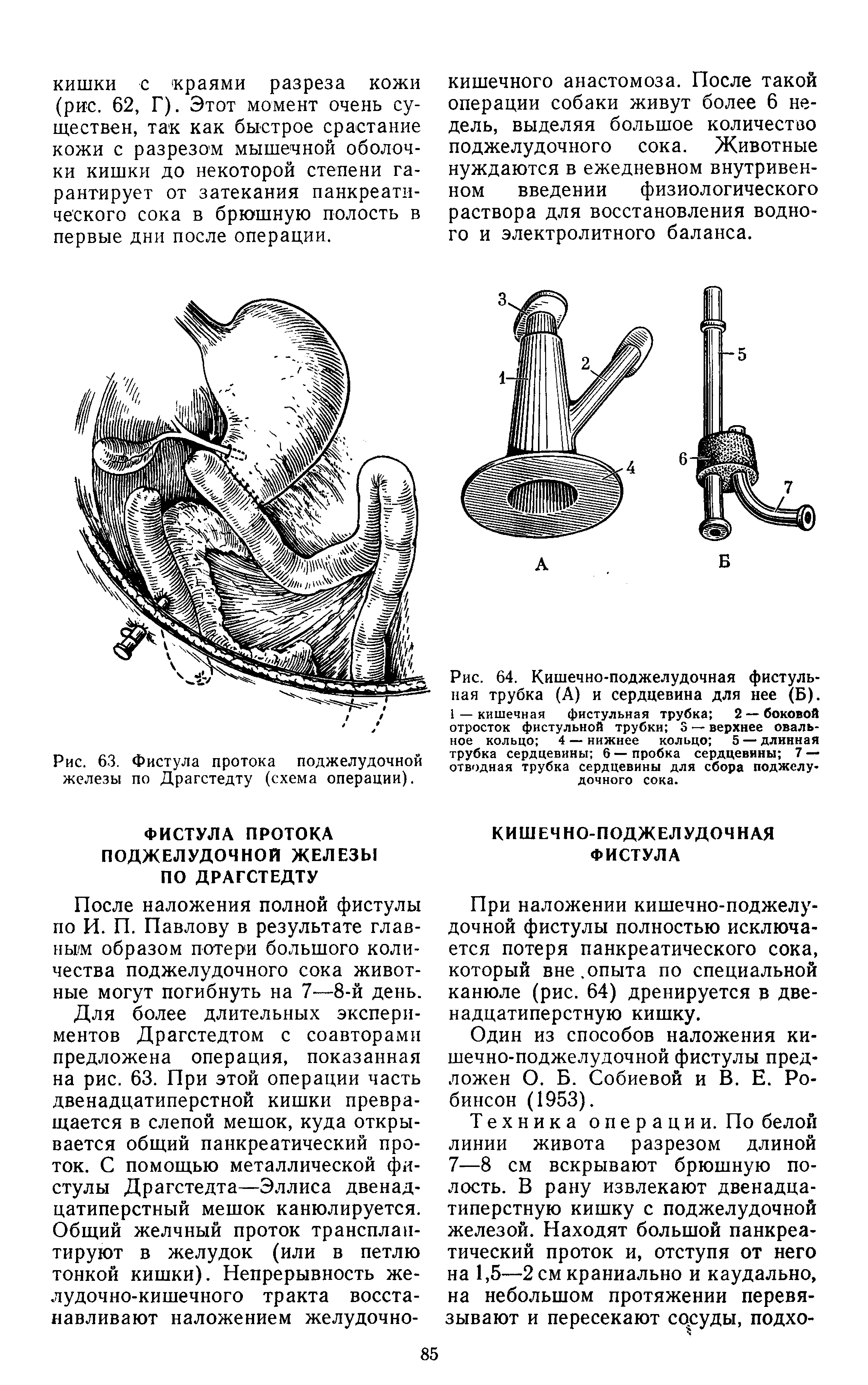 Рис. 64. Кишечно-поджелудочная фистульная трубка (А) и сердцевина для нее (Б). 1 — кишечная фистульная трубка 2 — боковой отросток фистульной трубки 3 — верхнее овальное кольцо 4 — нижнее кольцо 5 — длинная трубка сердцевины 6—пробка сердцевины 7 — отводная трубка сердцевины для сбора поджелудочного сока.