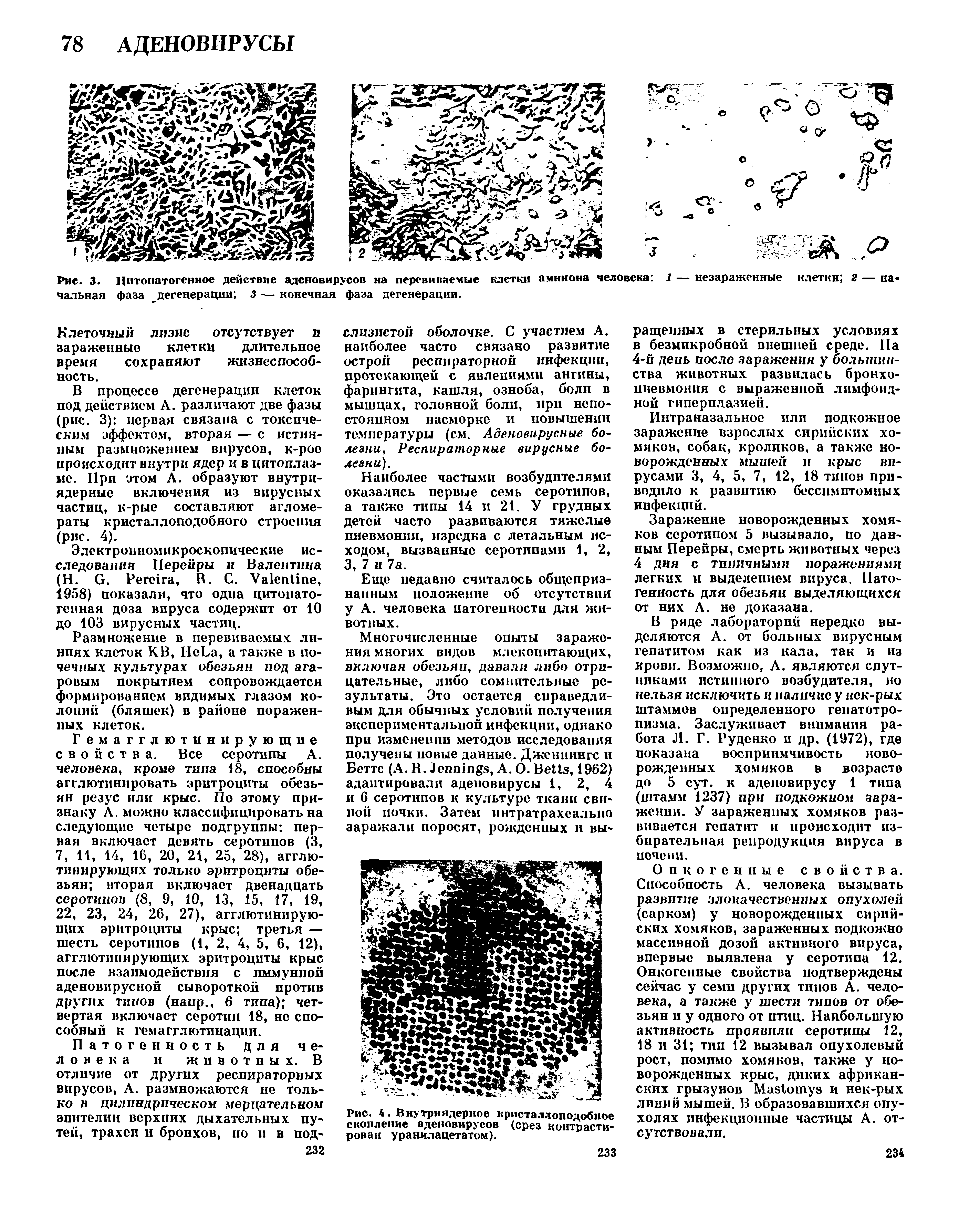 Рис. 3. Цитопатогенное действие аденовирусов на перевиваемые клетки амниона человека 1 — незаряженные клетки 2 — начальная фаза дегенерации 3 — конечная фаза дегенерации.