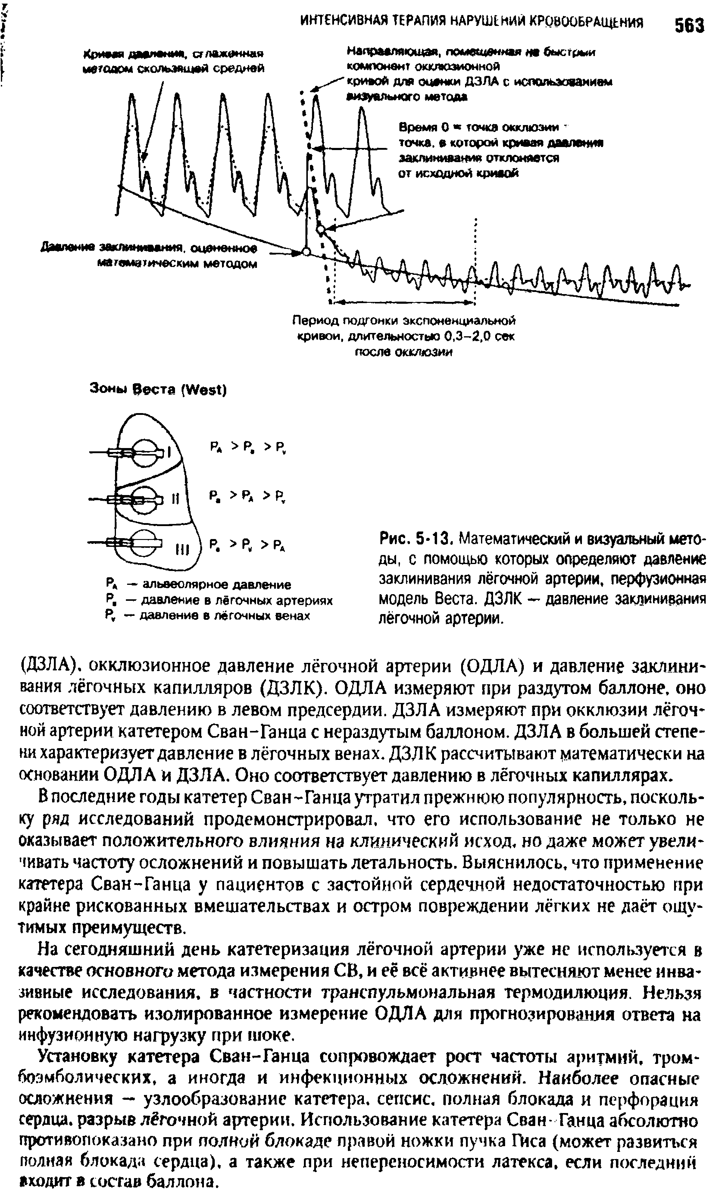 Рис. 5 13. Математический и визуальный методы, с помощью которых определяют давление заклинивания лёгочной артерии, перфузионная модель Веста. ДЗЛК — давление заклинивания лёгочной артерии.