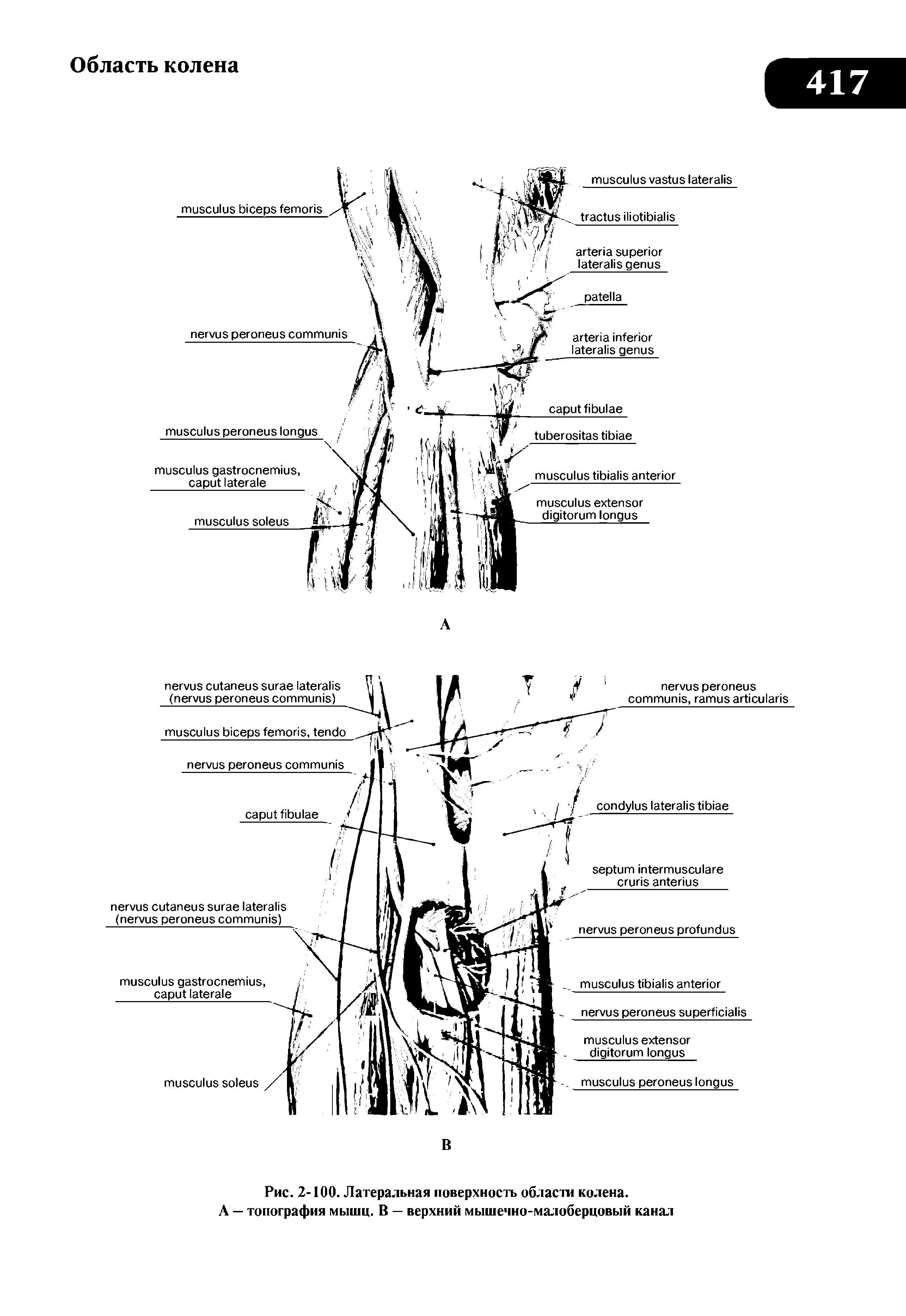 Рис. 2-100. Латеральная поверхность области колена. А — топография мышц. В — верхний мышечно-малоберцовый канал...