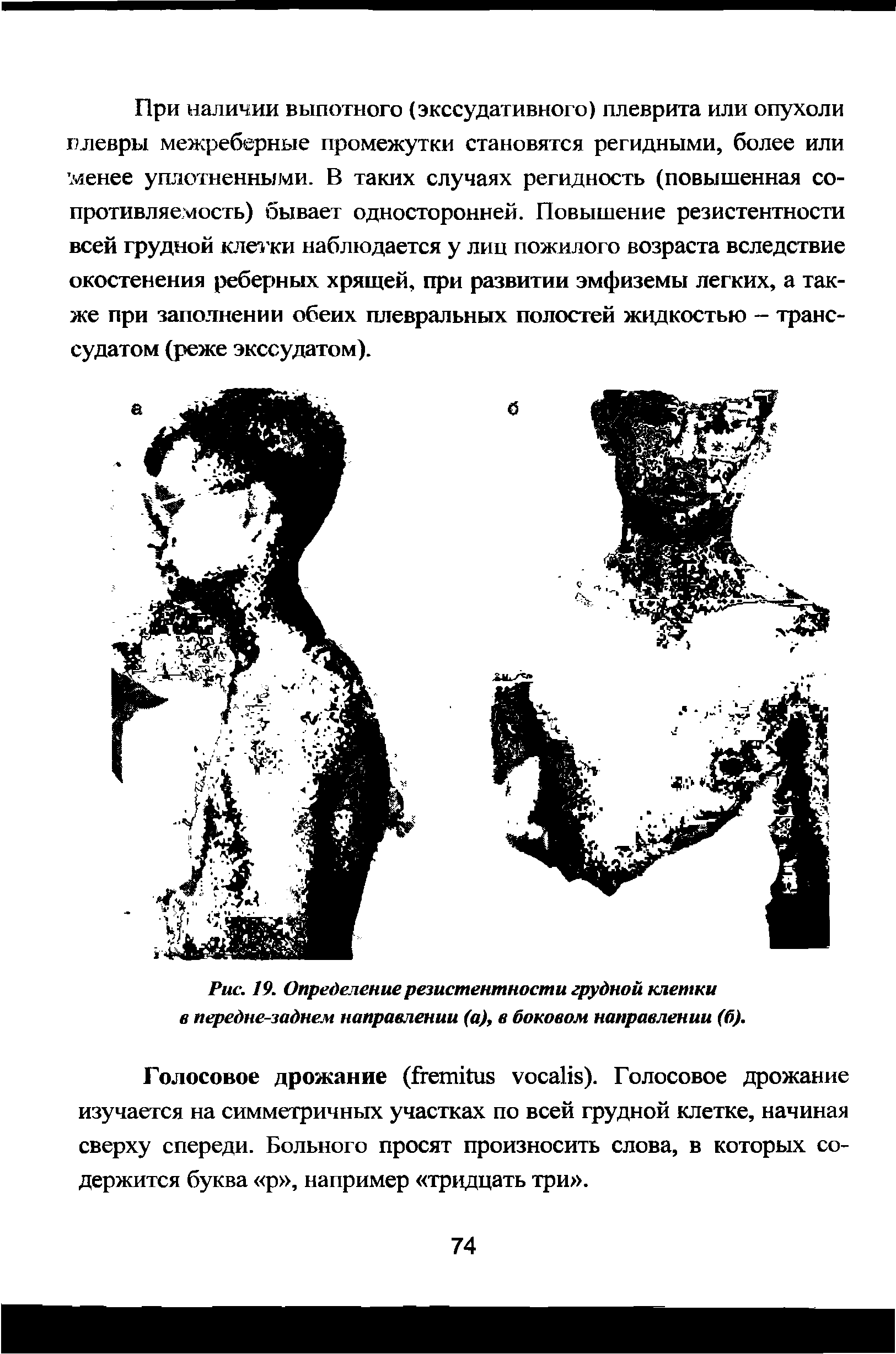 Рис. 19. Определение резистентности грудной клетки в передне-заднем направлении (а), в боковом направлении (б).