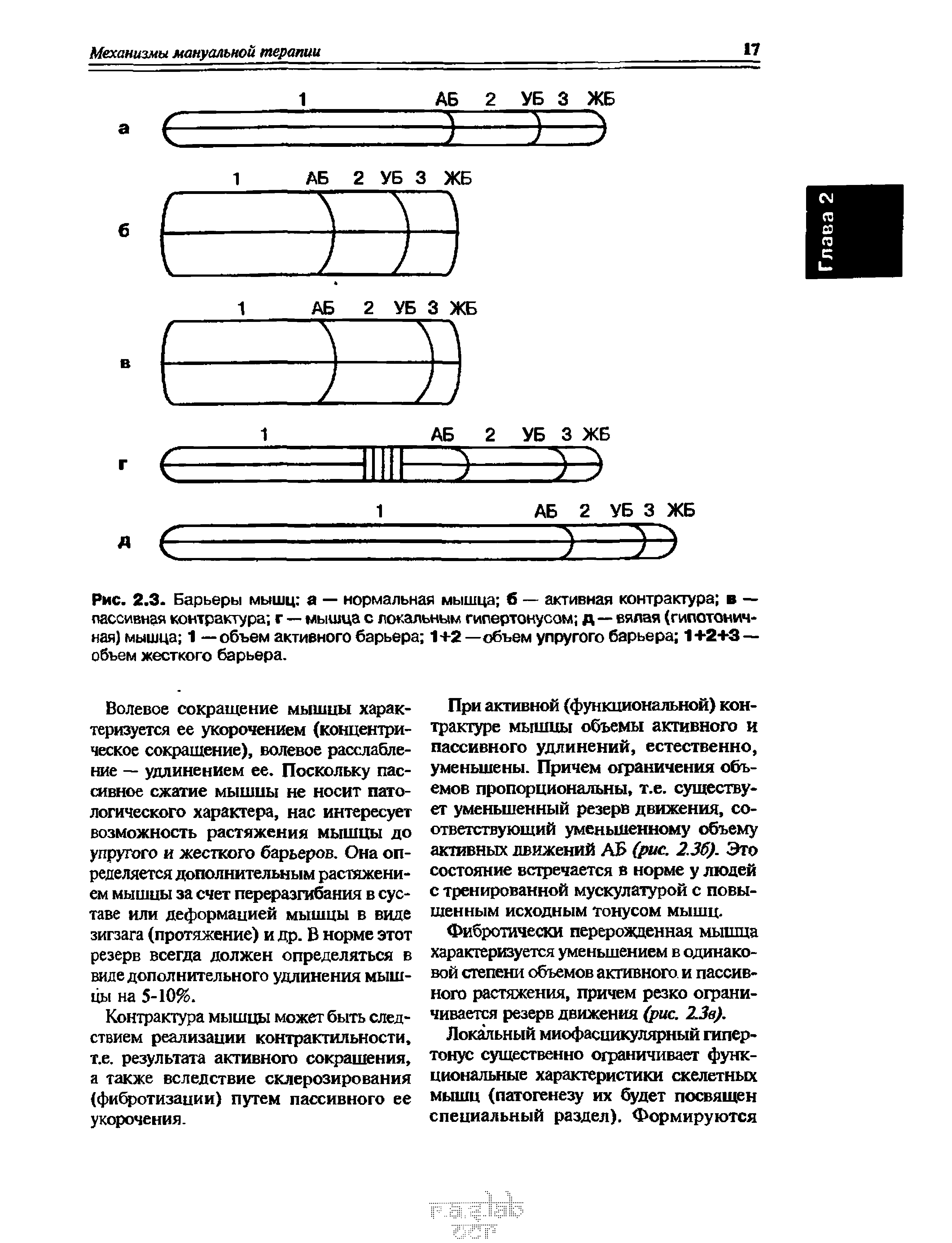 Рис. 2.3. Барьеры мышц а — нормальная мышца б — активная контрактура в — пассивная контрактура г — мышца с локальным гипертонусом д—вялая (гипотонич-ная) мышца 1 — объем активного барьера 1+2 —объем упругого барьера 1+2+3— объем жесткого барьера.