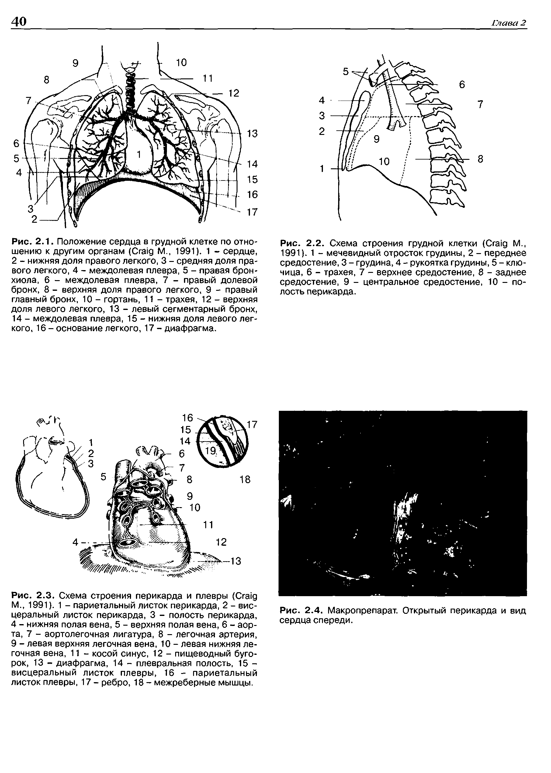 Рис. 2.2. Схема строения грудной клетки (C М., 1991). 1 - мечевидный отросток грудины, 2 - переднее средостение, 3 - грудина, 4 - рукоятка грудины, 5 - ключица, 6 - трахея, 7 - верхнее средостение, 8 - заднее средостение, 9 - центральное средостение, 10 - полость перикарда.