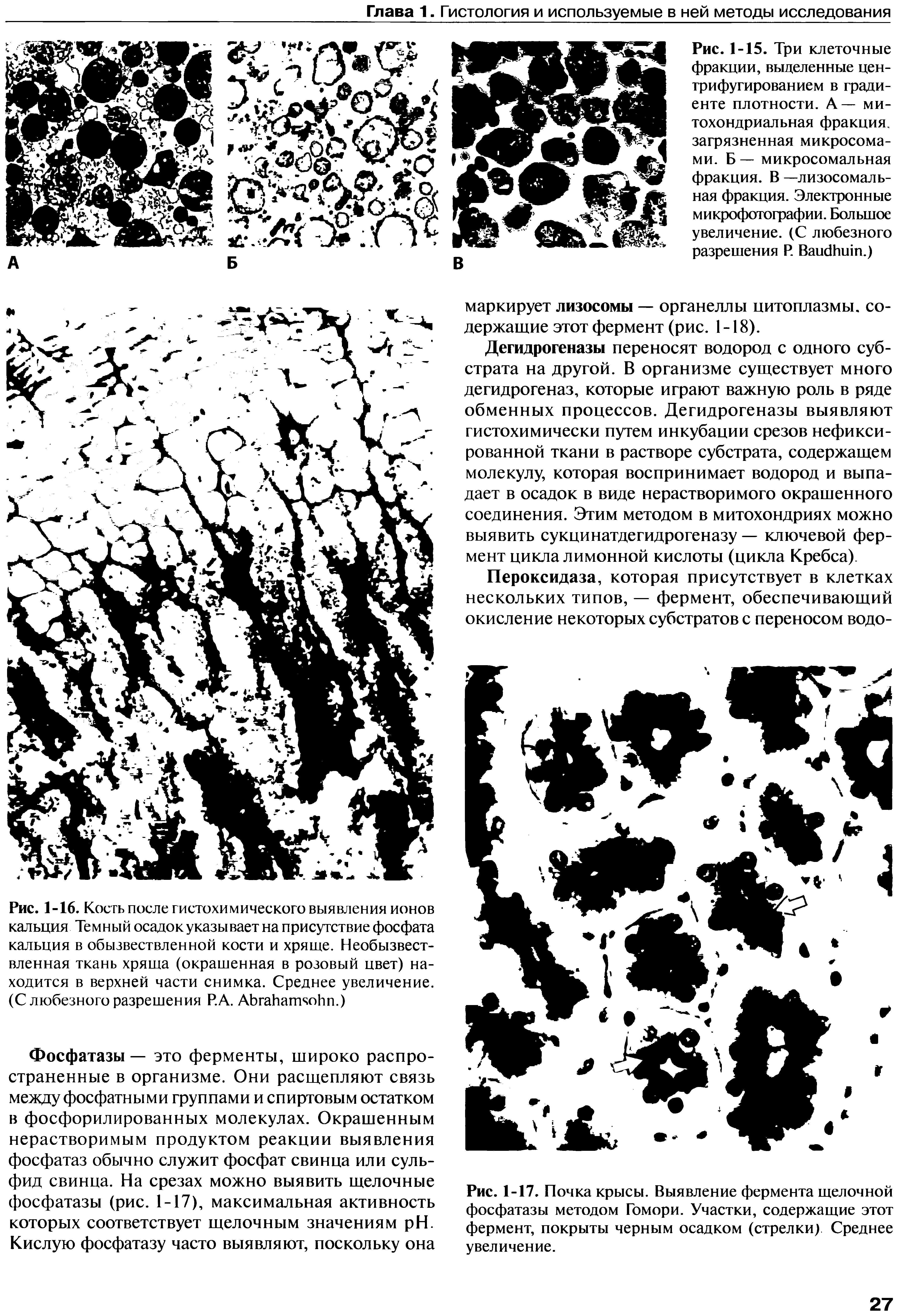 Рис. 1-17. Почка крысы. Выявление фермента щелочной фосфатазы методом Гомори. Участки, содержащие этот фермент, покрыты черным осадком (стрелки) Среднее увеличение.