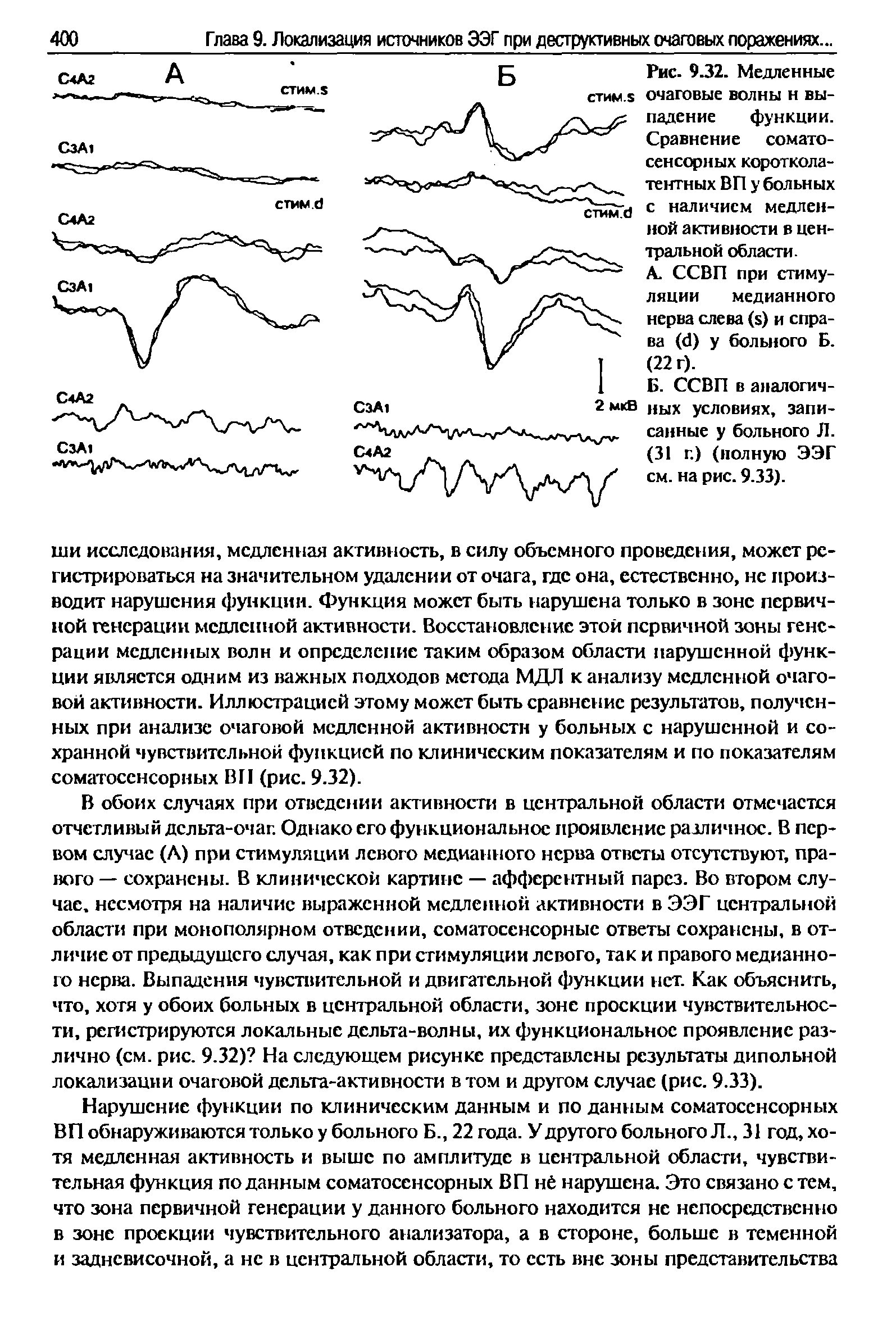 Рис. 9.32. Медленные очаговые волны н выпадение функции. Сравнение соматосенсорных коротколатентных ВП у больных с наличием медленной активности в центральной области.