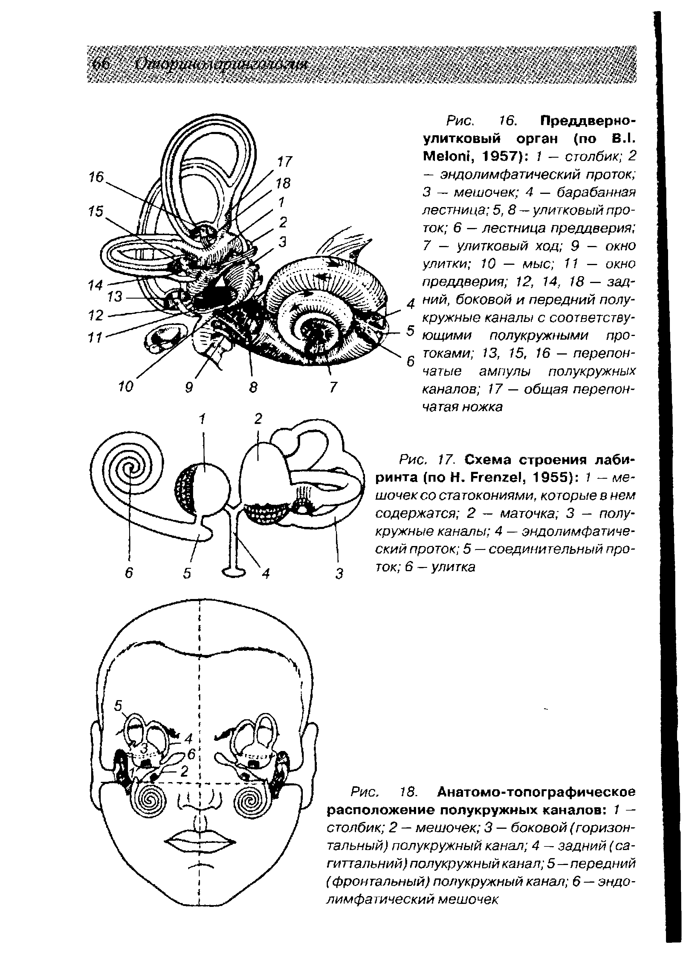 Рис. 18. Анатомо-топографическое расположение полукружных каналов 1 — столбик 2 — мешочек 3 — боковой (горизонтальный) полукружный канал 4 — задний (са-гиттальний) полукружный канал 5—передний (фронтальный) полукружный канал 6 — эндолимфатический мешочек...