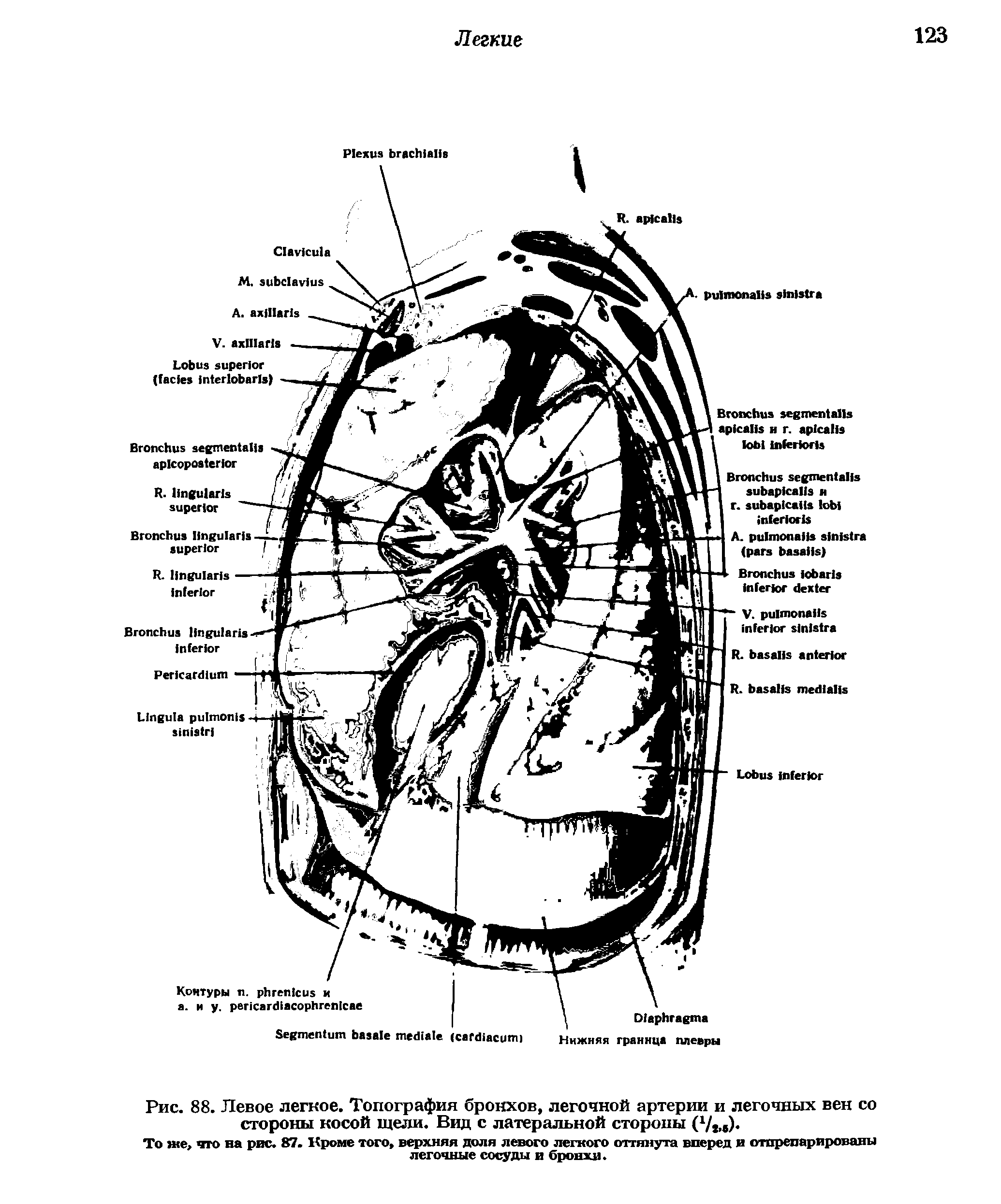 Рис. 88. Левое легкое. Топография бронхов, легочной артерии и легочных вен со стороны косой щели. Вид с латеральной стороны С1/. ) ...