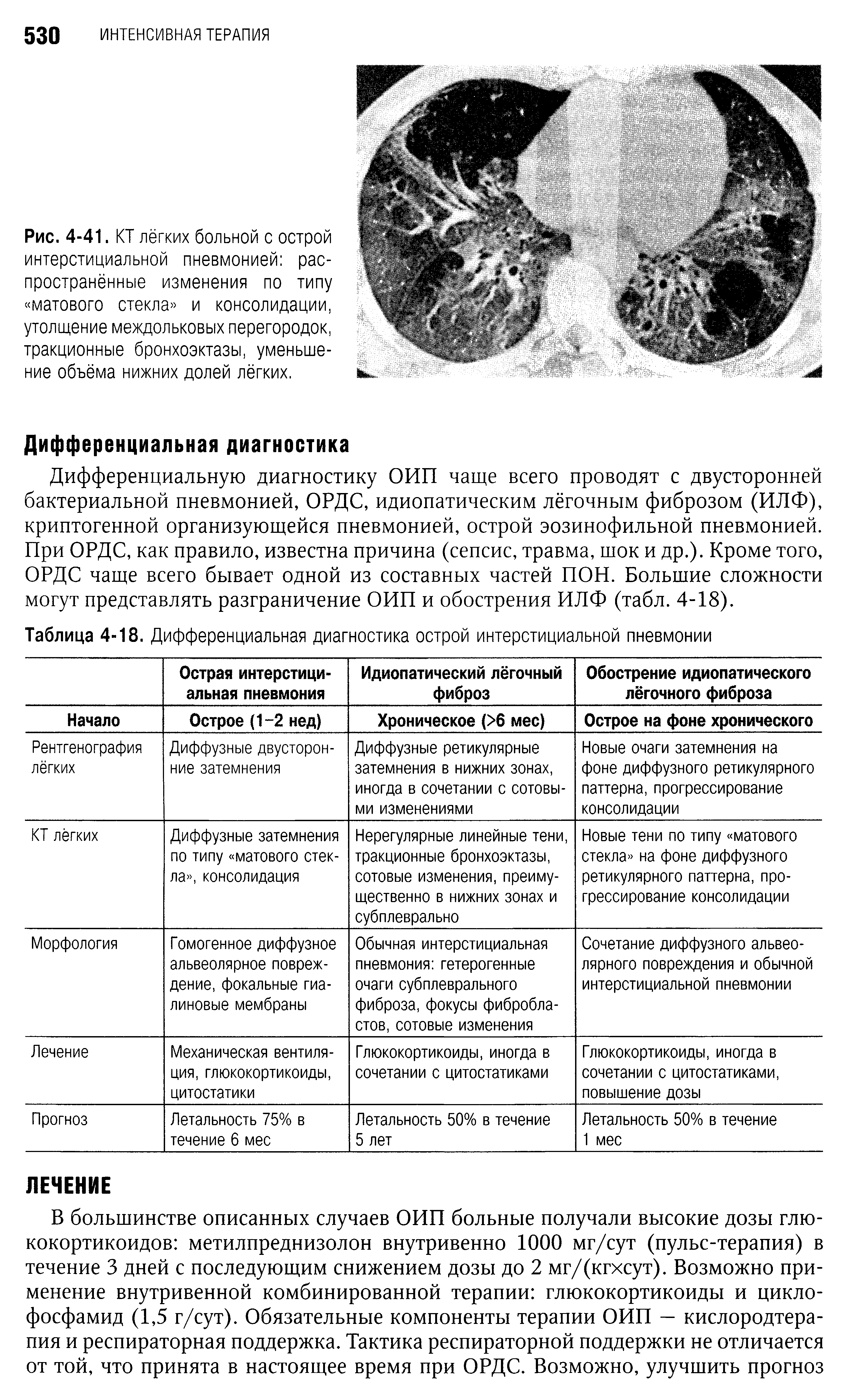 Таблица 4-18. Дифференциальная диагностика острой интерстициальной пневмонии...