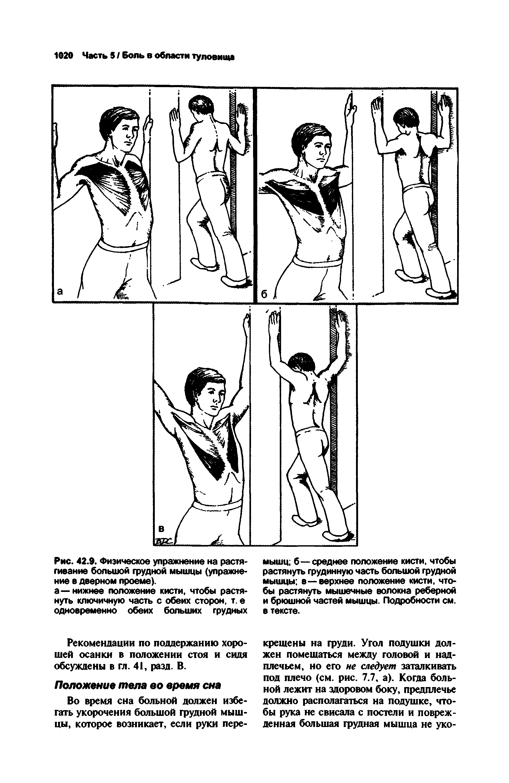 Рис. 42.9. Физическое упражнение на растягивание большой грудной мышцы (упражнение в дверном проеме).