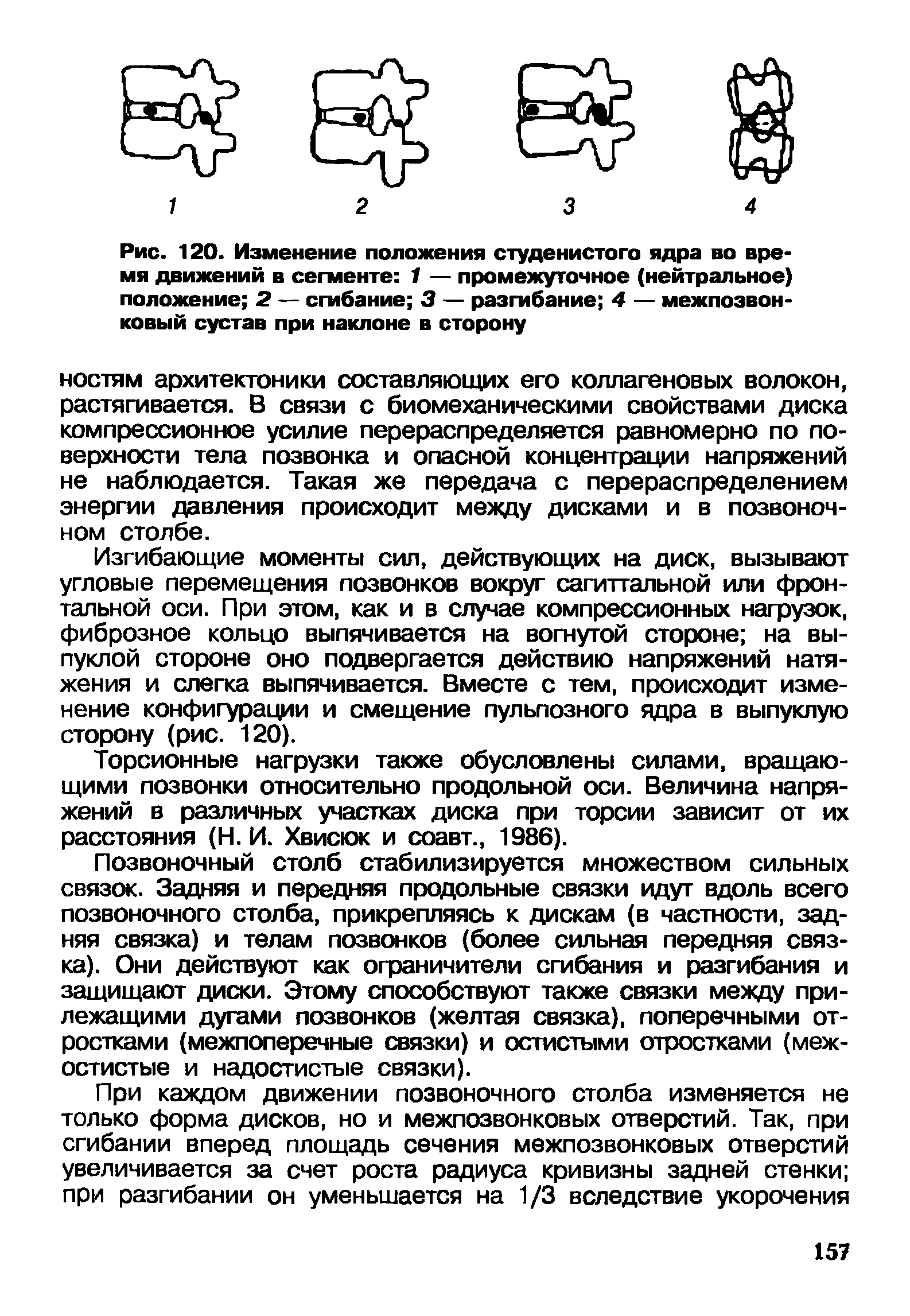 Рис. 120. Изменение положения студенистого ядра во время движений в сегменте 1 — промежуточное (нейтральное) положение 2 — сгибание 3 — разгибание 4 — межпозвонковый сустав при наклоне в сторону...