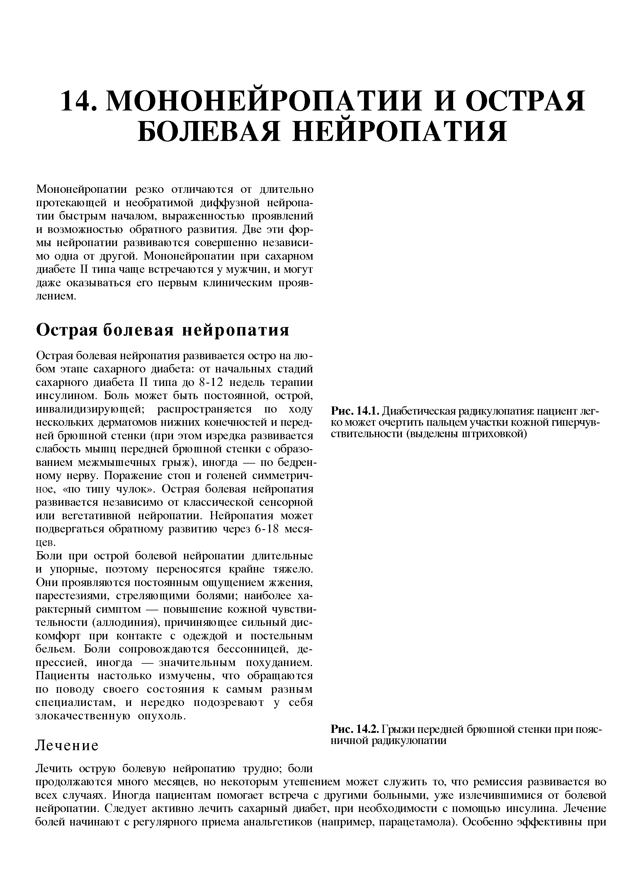 Рис. 14.2. Грыжи передней брюшной стенки при поясничной радикулопатии...