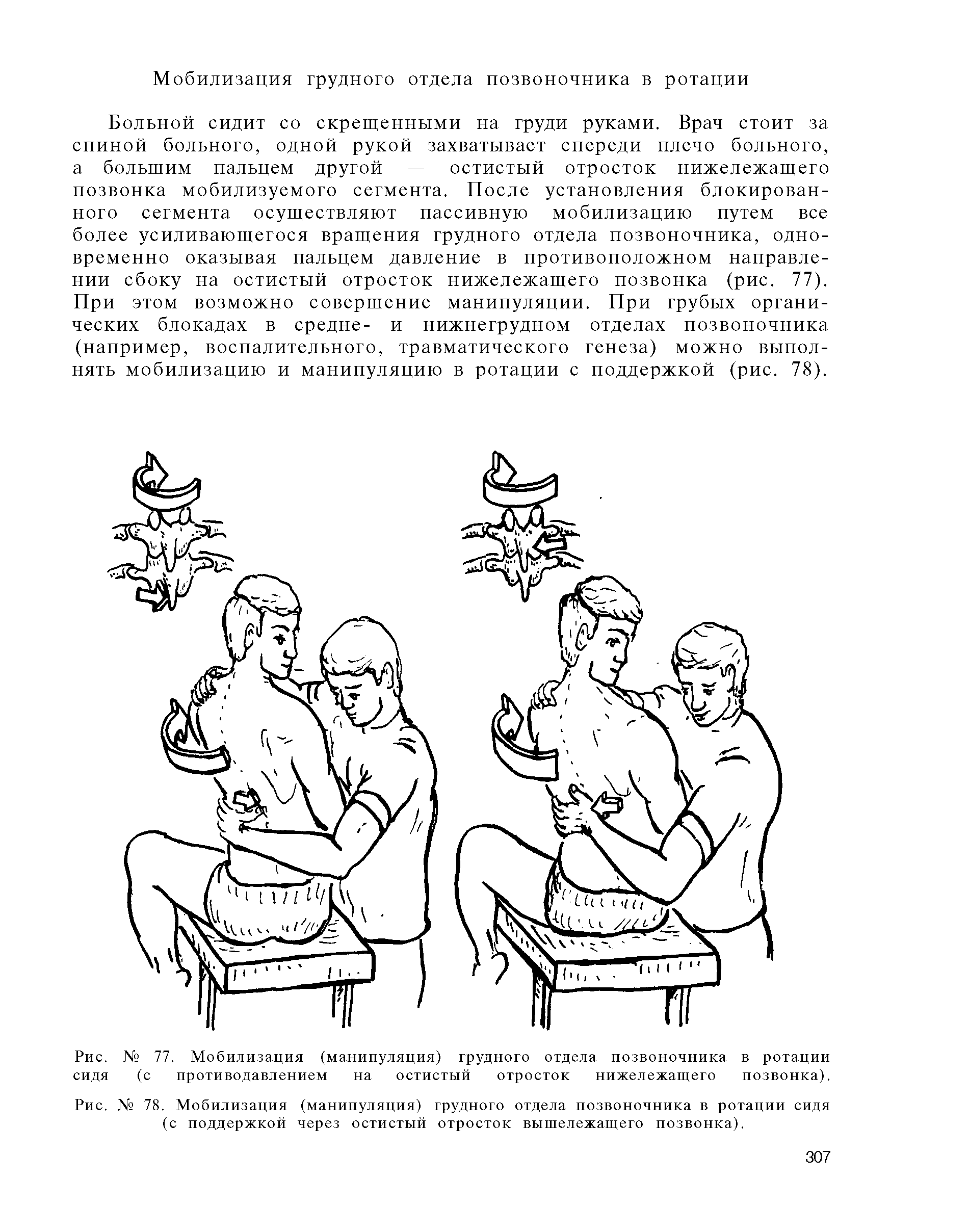 Рис. № 77. Мобилизация (манипуляция) грудного отдела позвоночника в ротации сидя (с противодавлением на остистый отросток нижележащего позвонка).