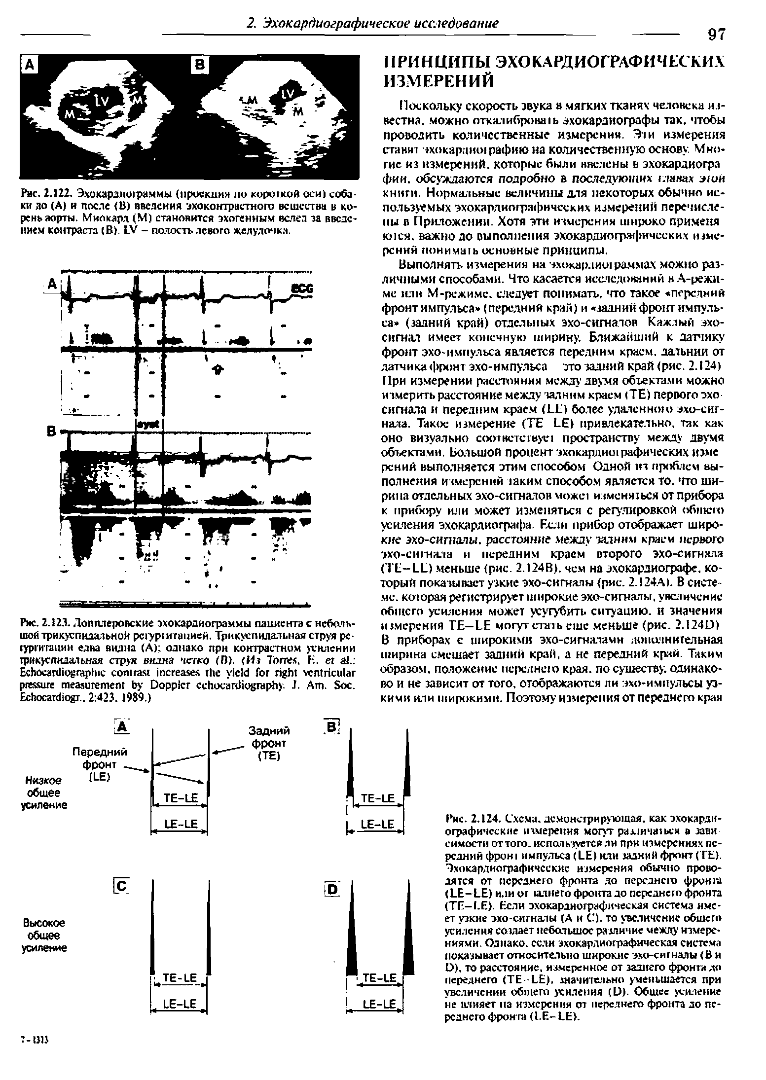 Рис. 2.122. Эхокарднсчраммы (проекция по корогкой оси) собаки до (А) и после (В) введения эхоконтрастного вещества в корень аорты. Миокард (М) становится эхогенным ветел за введением контраста (В). ЕУ - полость левого желудочка.