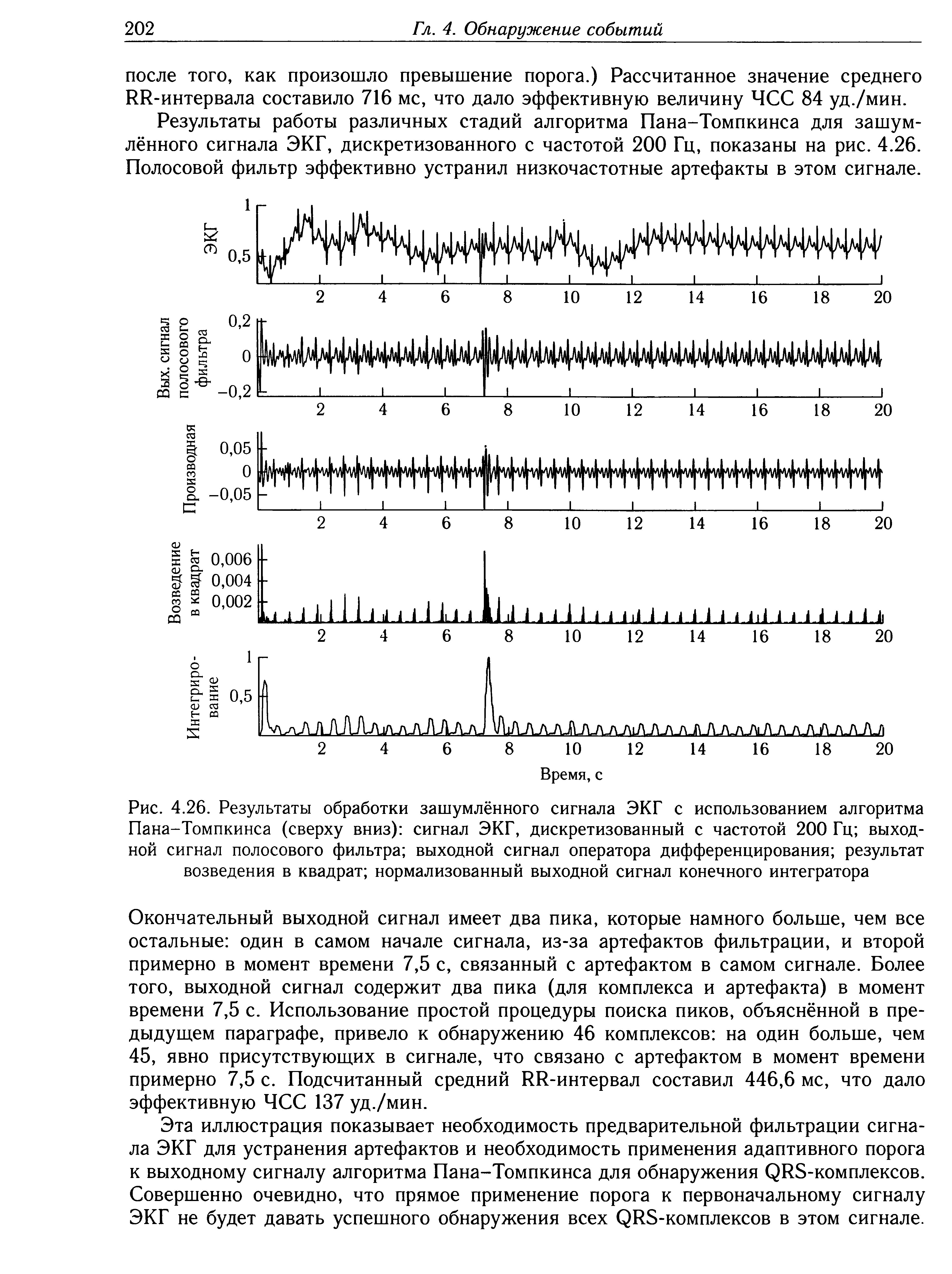 Рис. 4.26. Результаты обработки зашумлённого сигнала ЭКГ с использованием алгоритма Пана-Томпкинса (сверху вниз) сигнал ЭКГ, дискретизованный с частотой 200 Гц выходной сигнал полосового фильтра выходной сигнал оператора дифференцирования результат возведения в квадрат нормализованный выходной сигнал конечного интегратора...