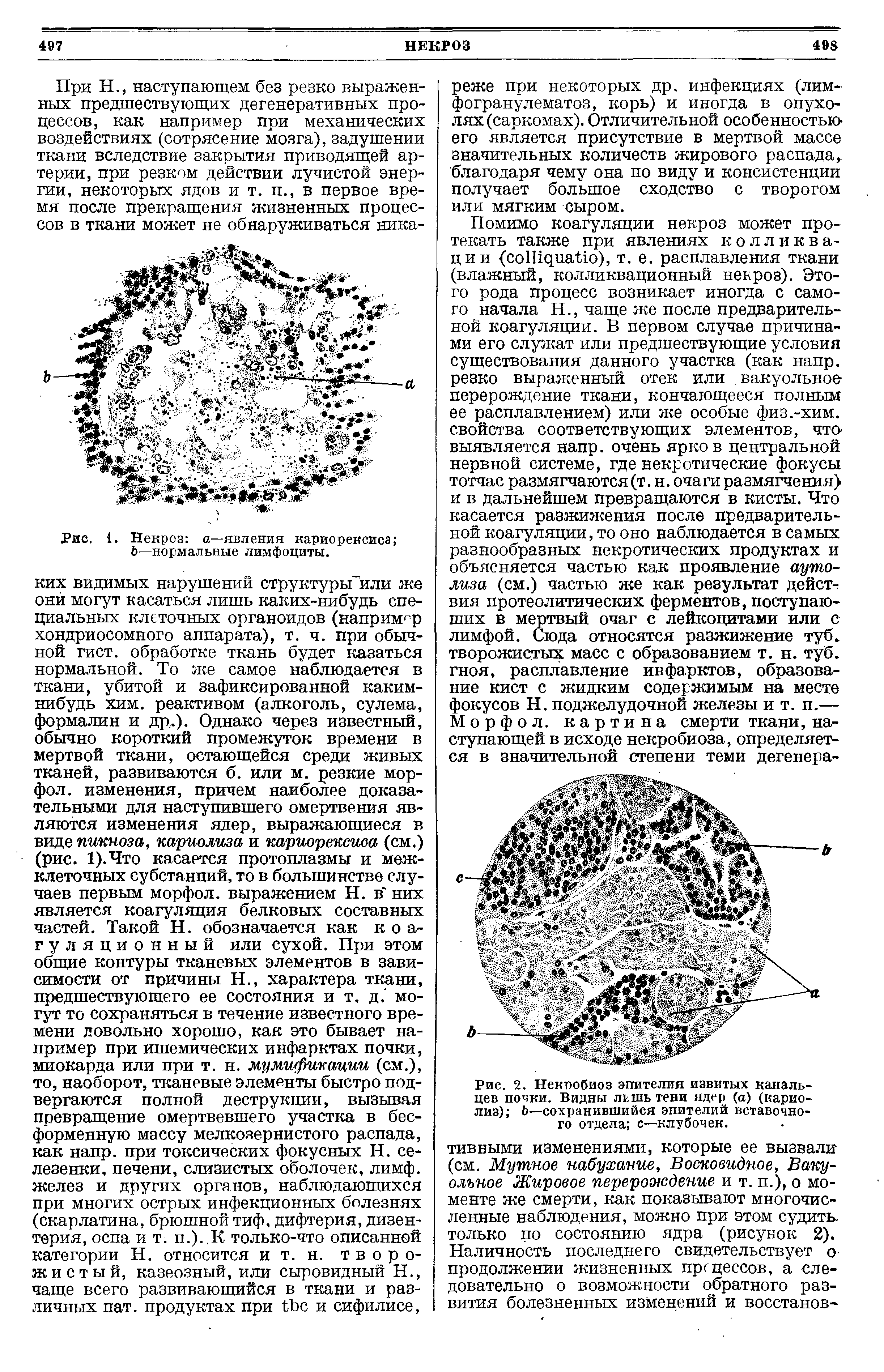 Рис. 2. Некробиоз эпителия извитых канальцев почки. Видны лг.шь тени ядер (а) (карио-лиз) Ь—сохранившийся эпителий вставочного отдела с—клубочек.