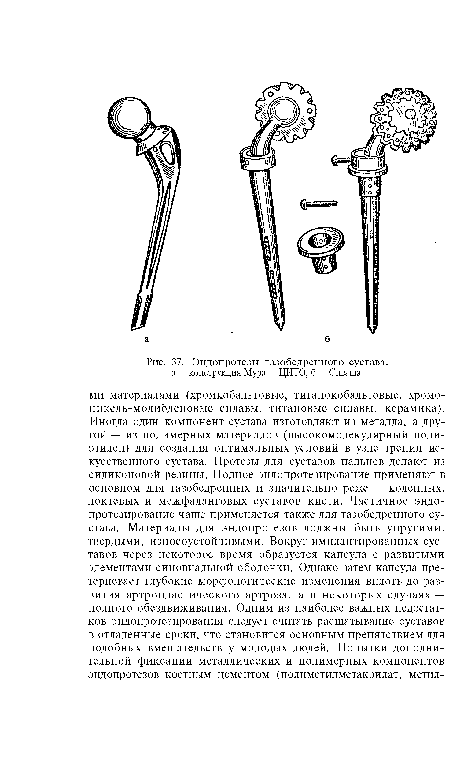 Рис. 37. Эндопротезы тазобедренного сустава, а — конструкция Мура — ЦИТО, б — Сиваша.