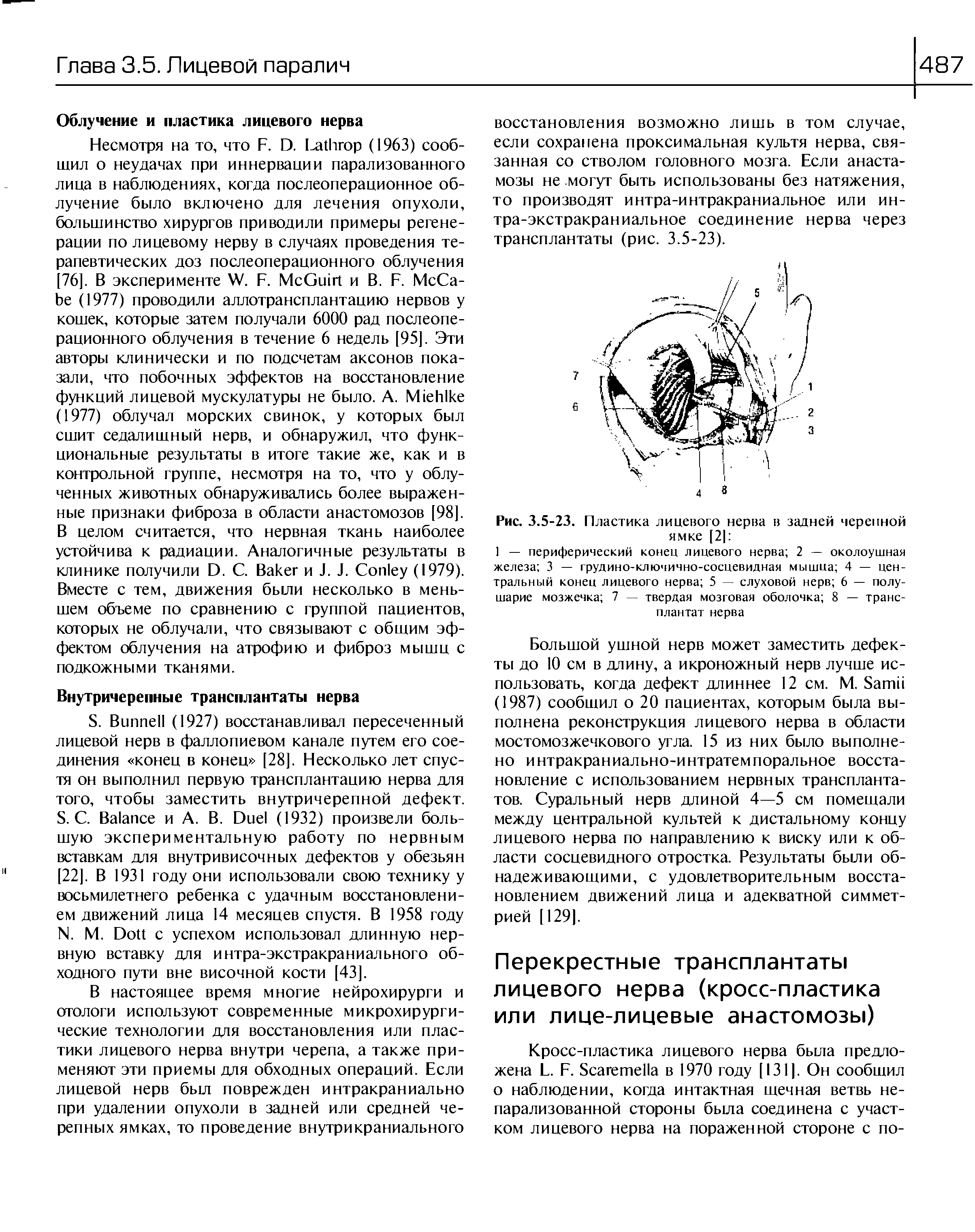 Рис. 3.5-23. Пластика лицевого нерва в задней черепной ямке [2 ...