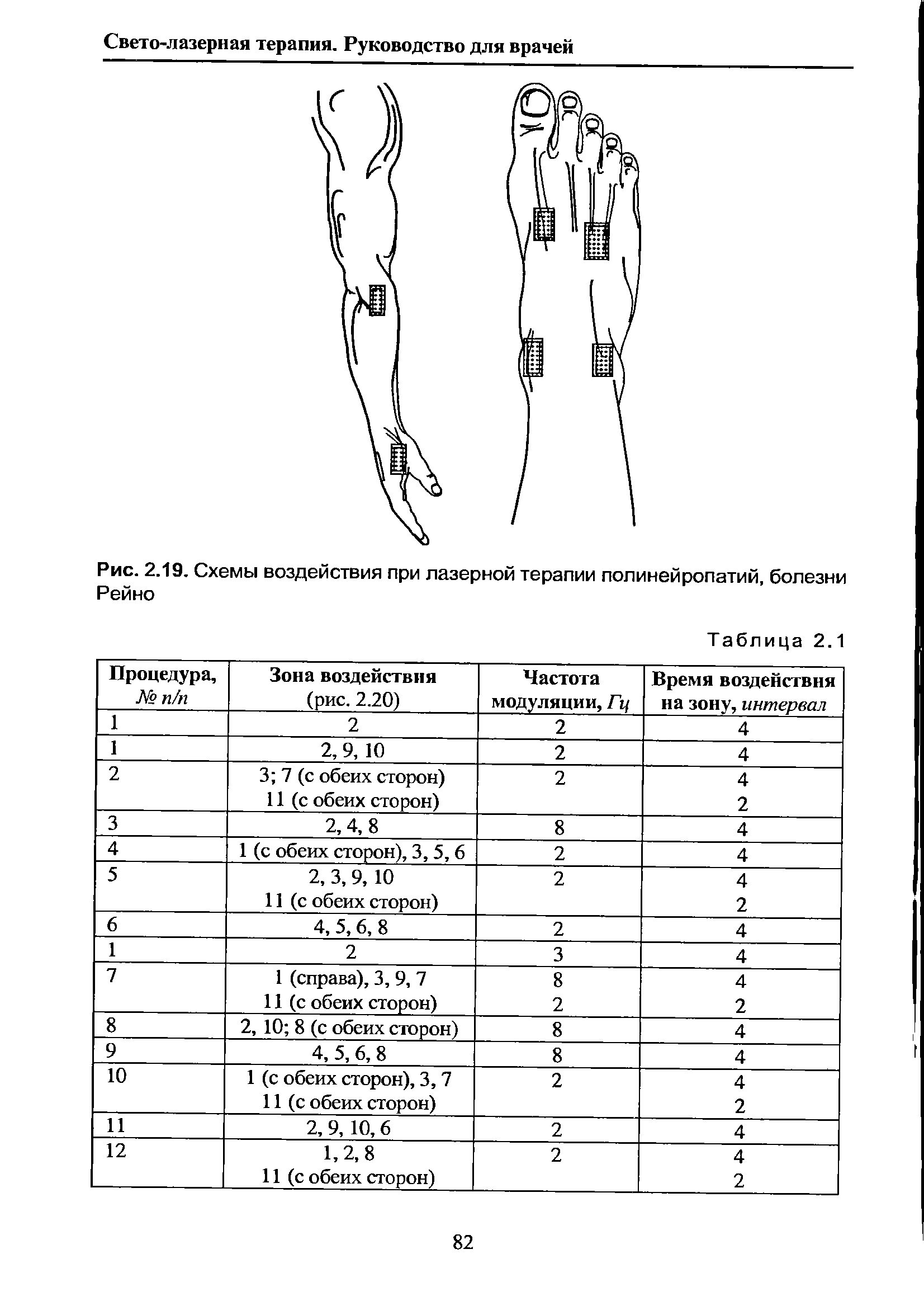 Рис. 2.19. Схемы воздействия при лазерной терапии полинейропатий, болезни Рейно...