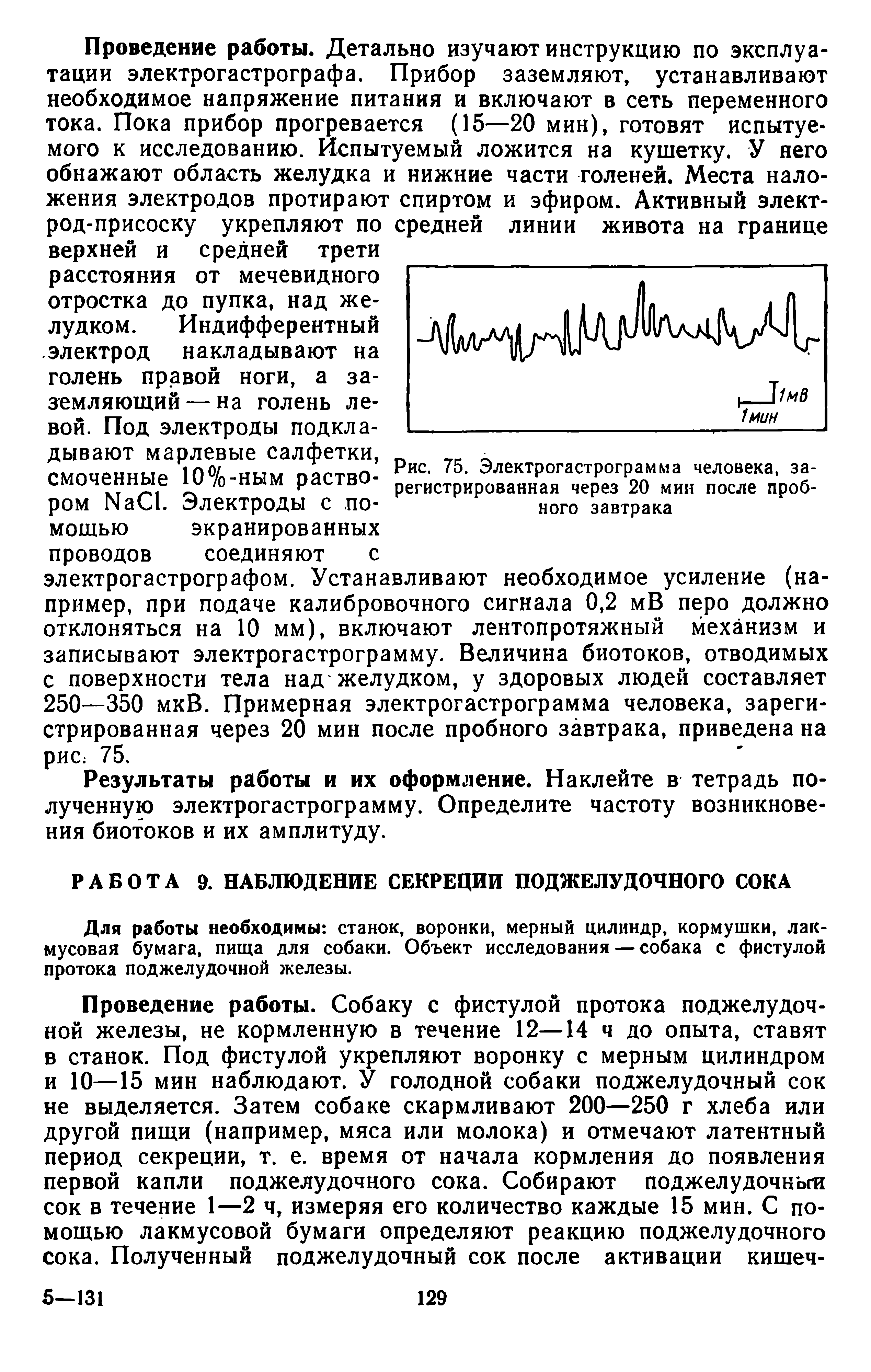 Рис. 75. Электрогастрограмма человека, зарегистрированная через 20 мин после пробного завтрака...