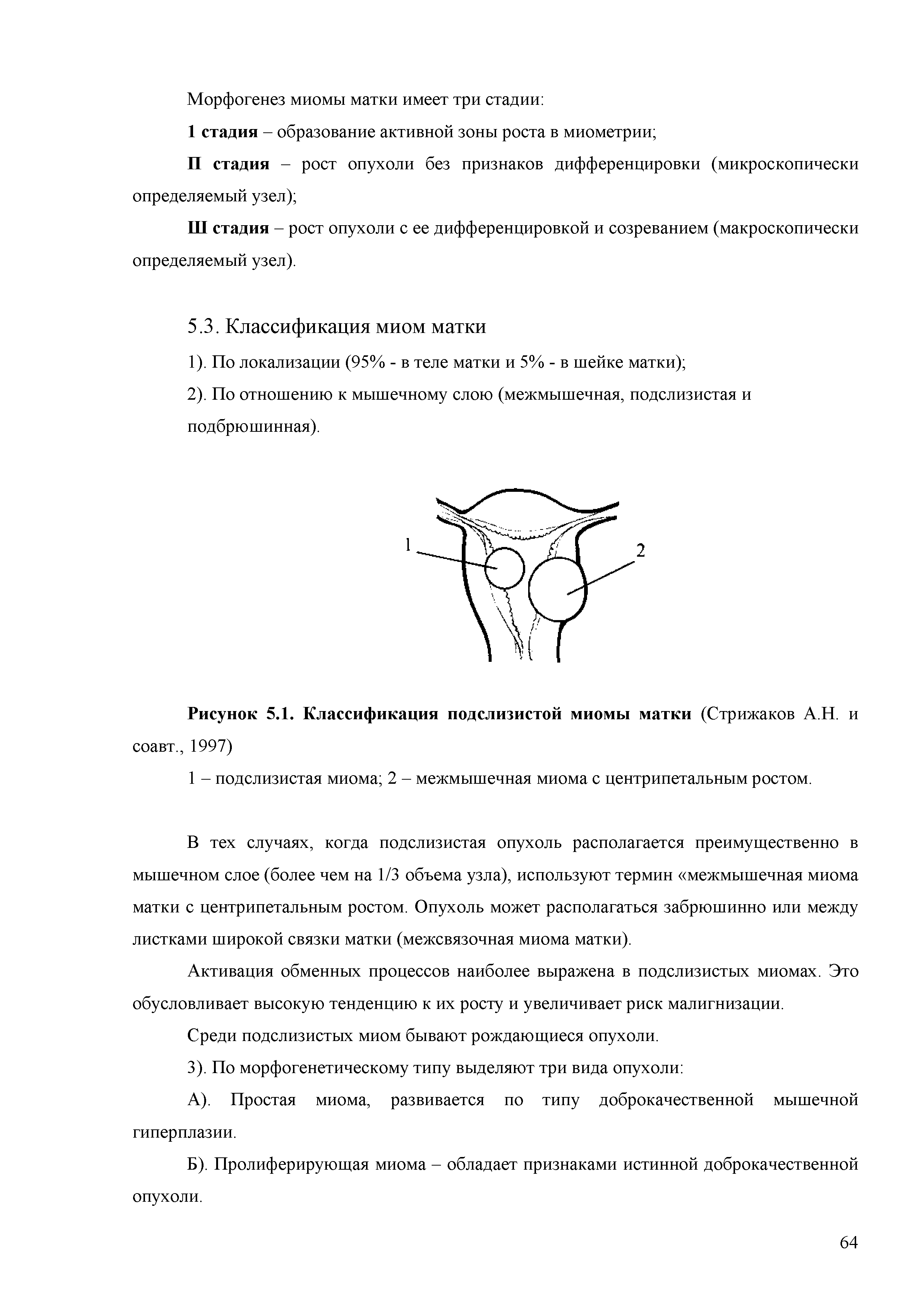 Рисунок 5.1. Классификация подслизистой миомы матки (Стрижаков АН. и...