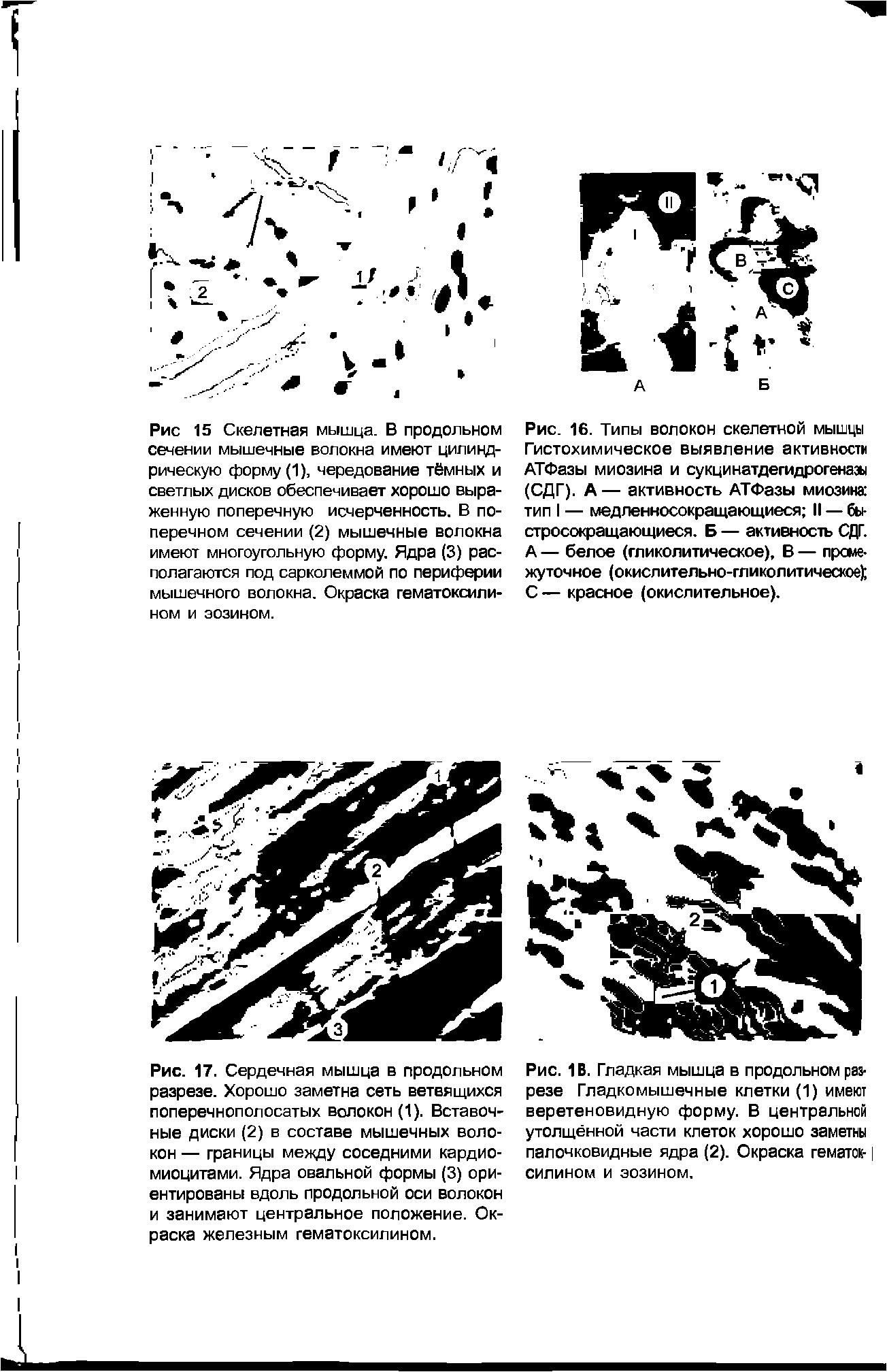 Рис. 16. Типы волокон скелетной мышцы Гистохимическое выявление активности АТФазы миозина и сукцинатдегидрогеназы (СДГ). А— активность АТФазы миозина тип I — медленносокращающиеся II — бы-стросокращающиеся. Б — активность СДГ. А — белое (гликолитическое), В — промежуточное (окислительно-гликолитическое) С — красное (окислительное).