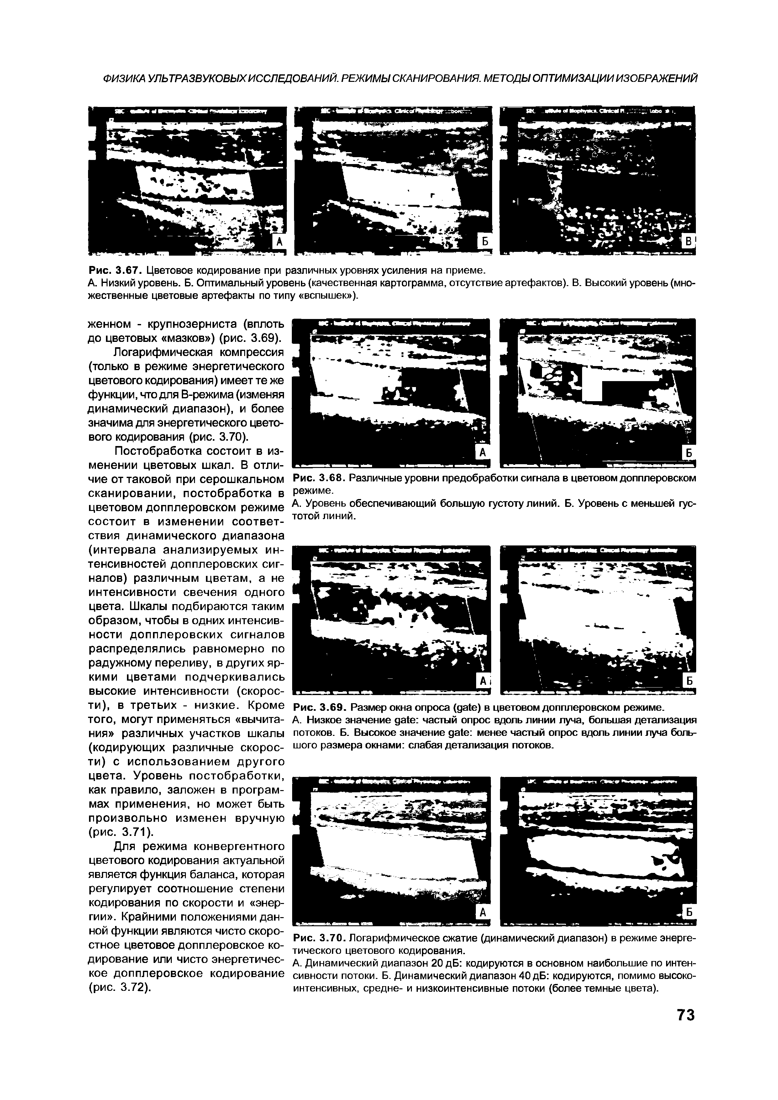 Рис. 3.69. Размер окна опроса ( ) в цветовом допплеровском режиме.