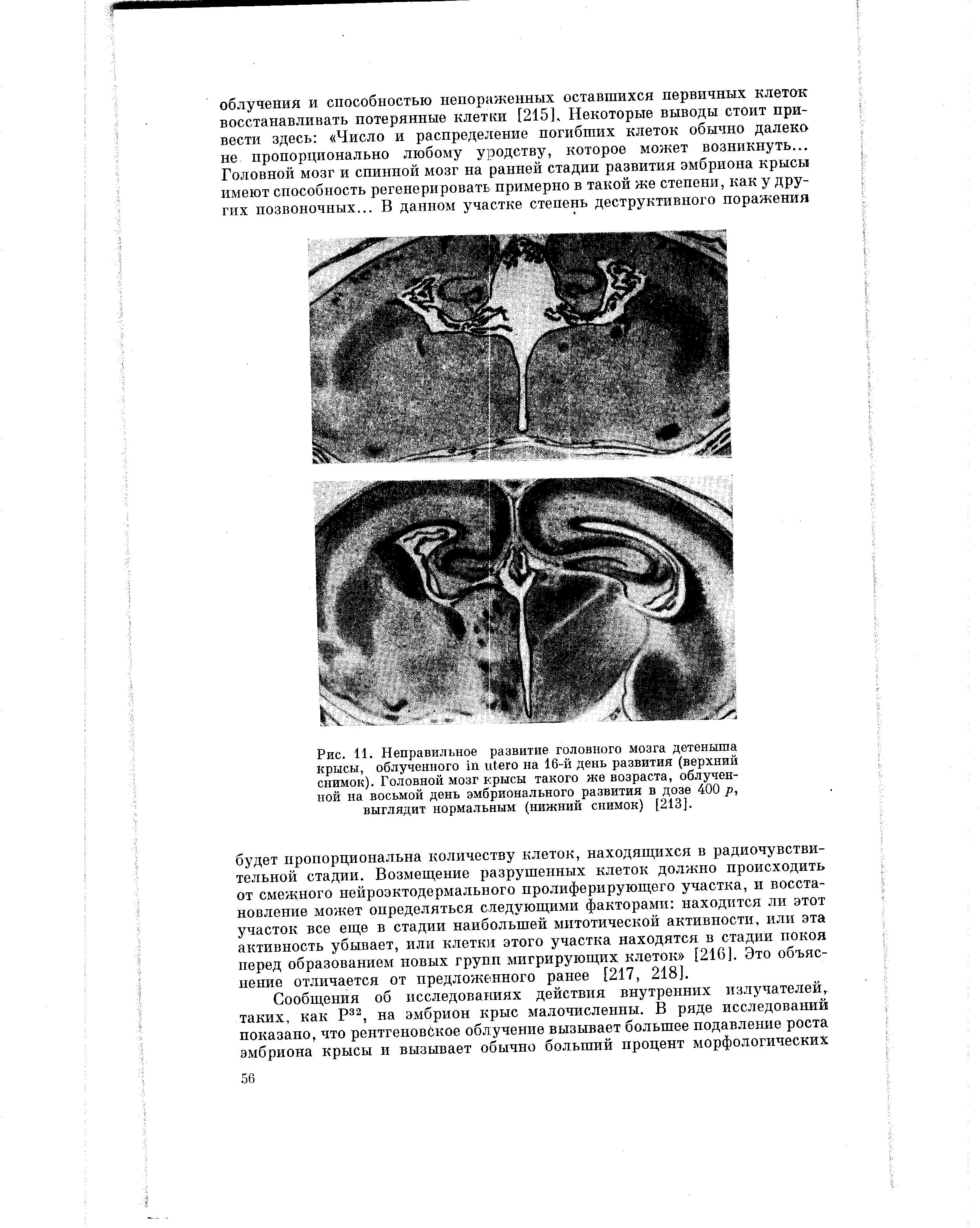 Рис. 11. Неправильное развитие головного мозга детеныша Крысы, облученного на 16-й день развития (верхний снимок). Головной мозг крысы такого же возраста, облученной на восьмой день эмбрионального развития в дозе 400 р, выглядит нормальным (нижний снимок) [213].