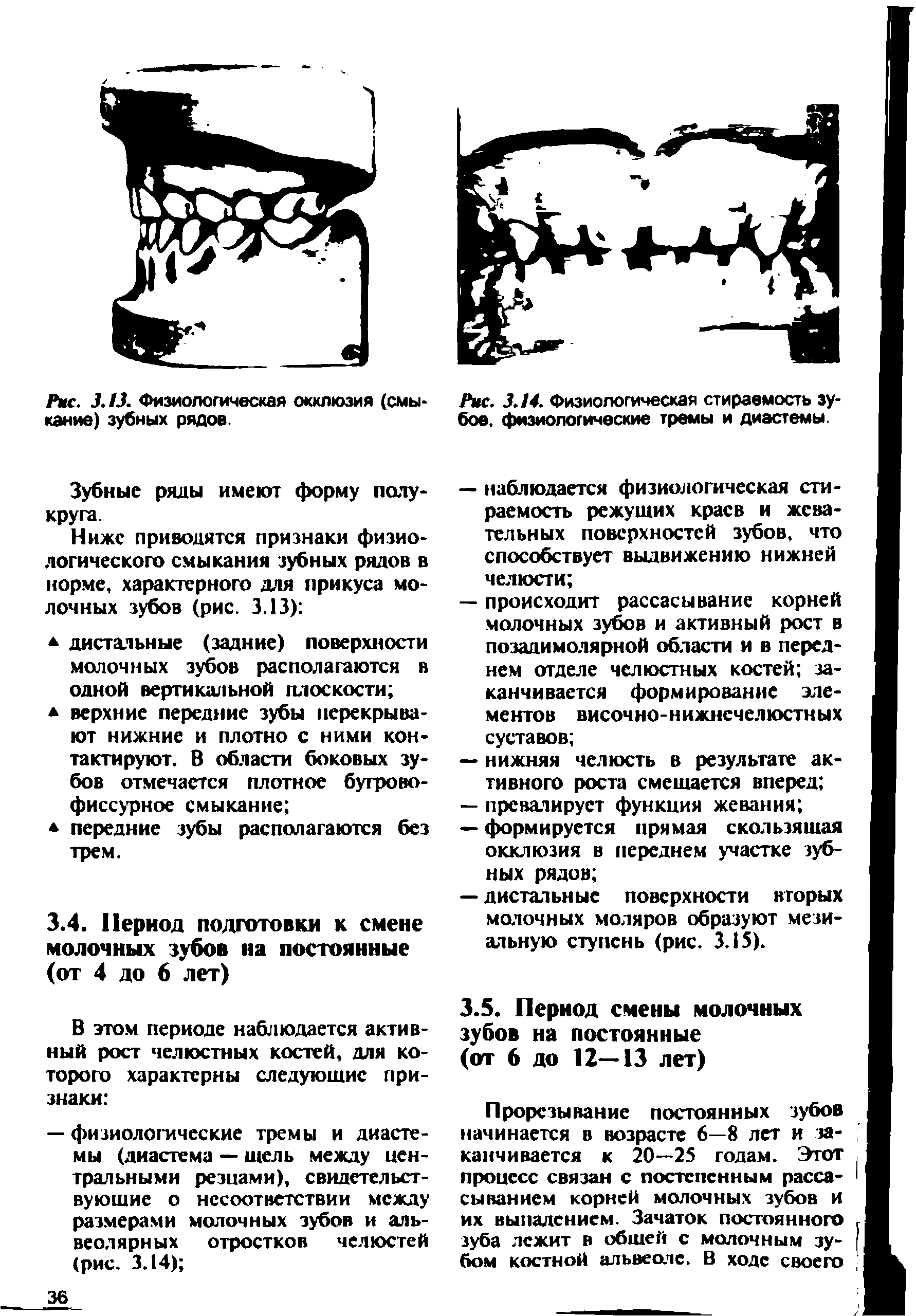 Рис. 3.14. Физиологическая стираемость зубов, физиологические тремы и диастемы.