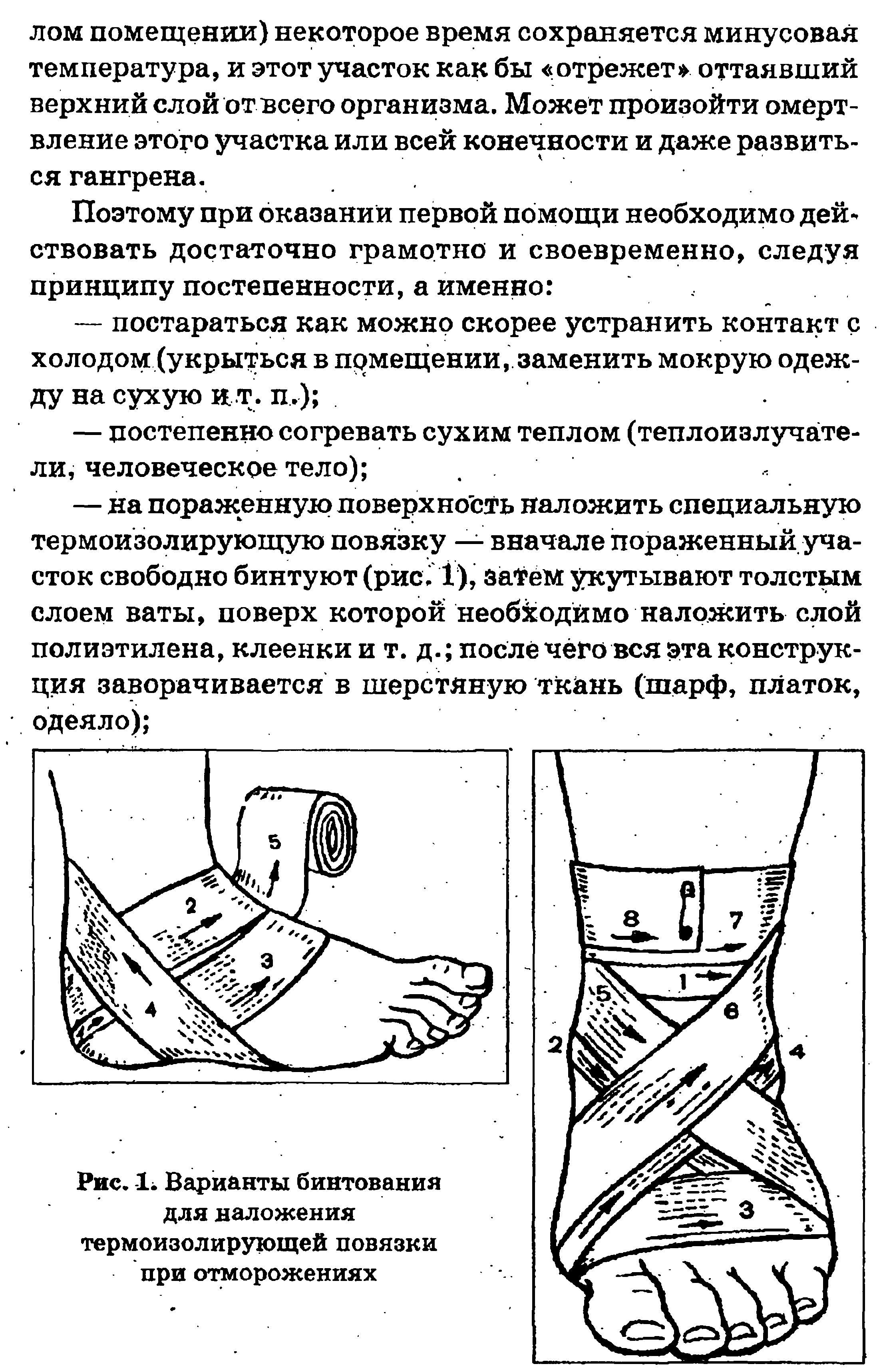 Рис. Ь Варианты бинтования для наложения термоизолирующей повязки при отморожениях...