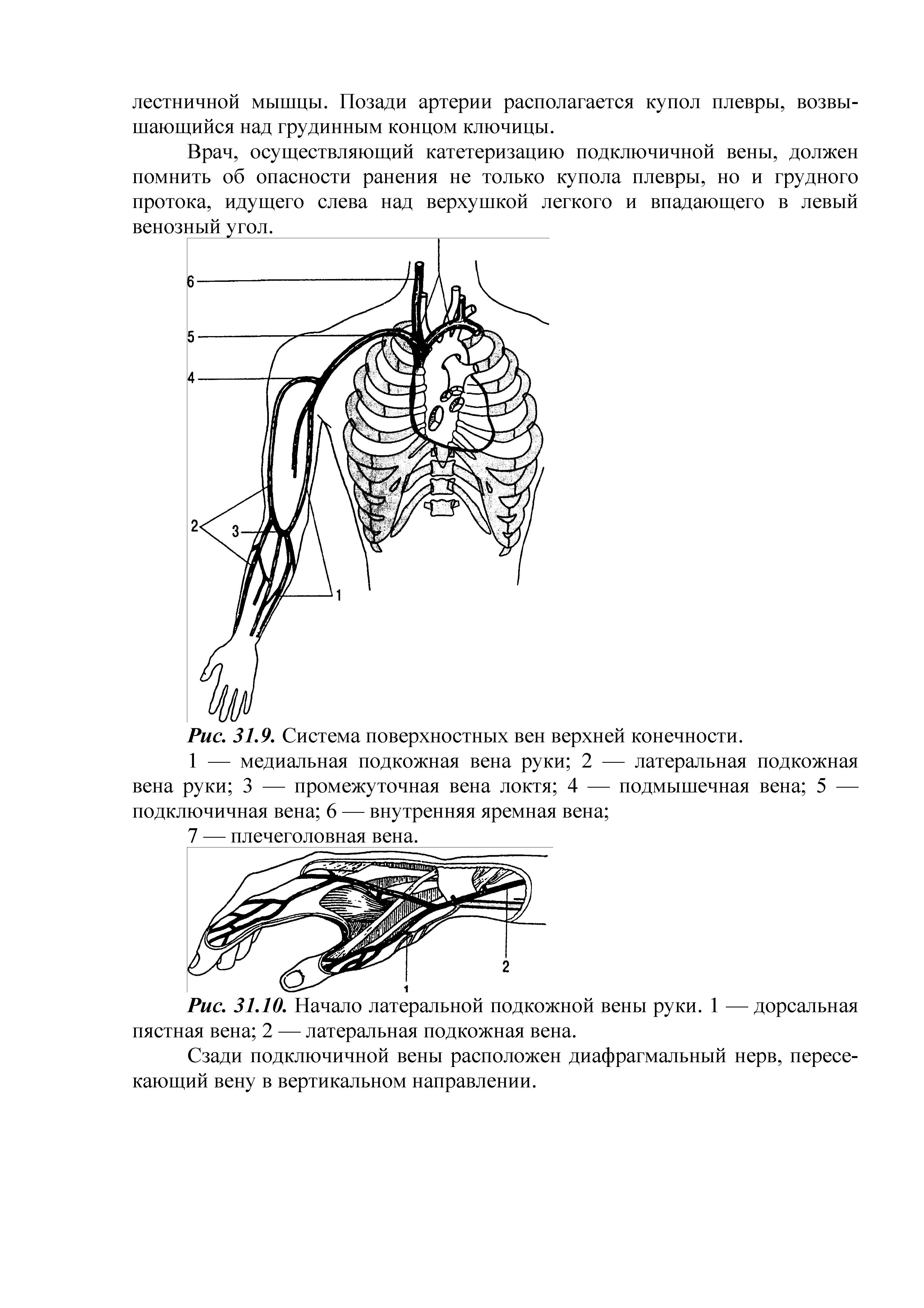 Рис. 31.10. Начало латеральной подкожной вены руки. 1 —дорсальная пястная вена 2 — латеральная подкожная вена.