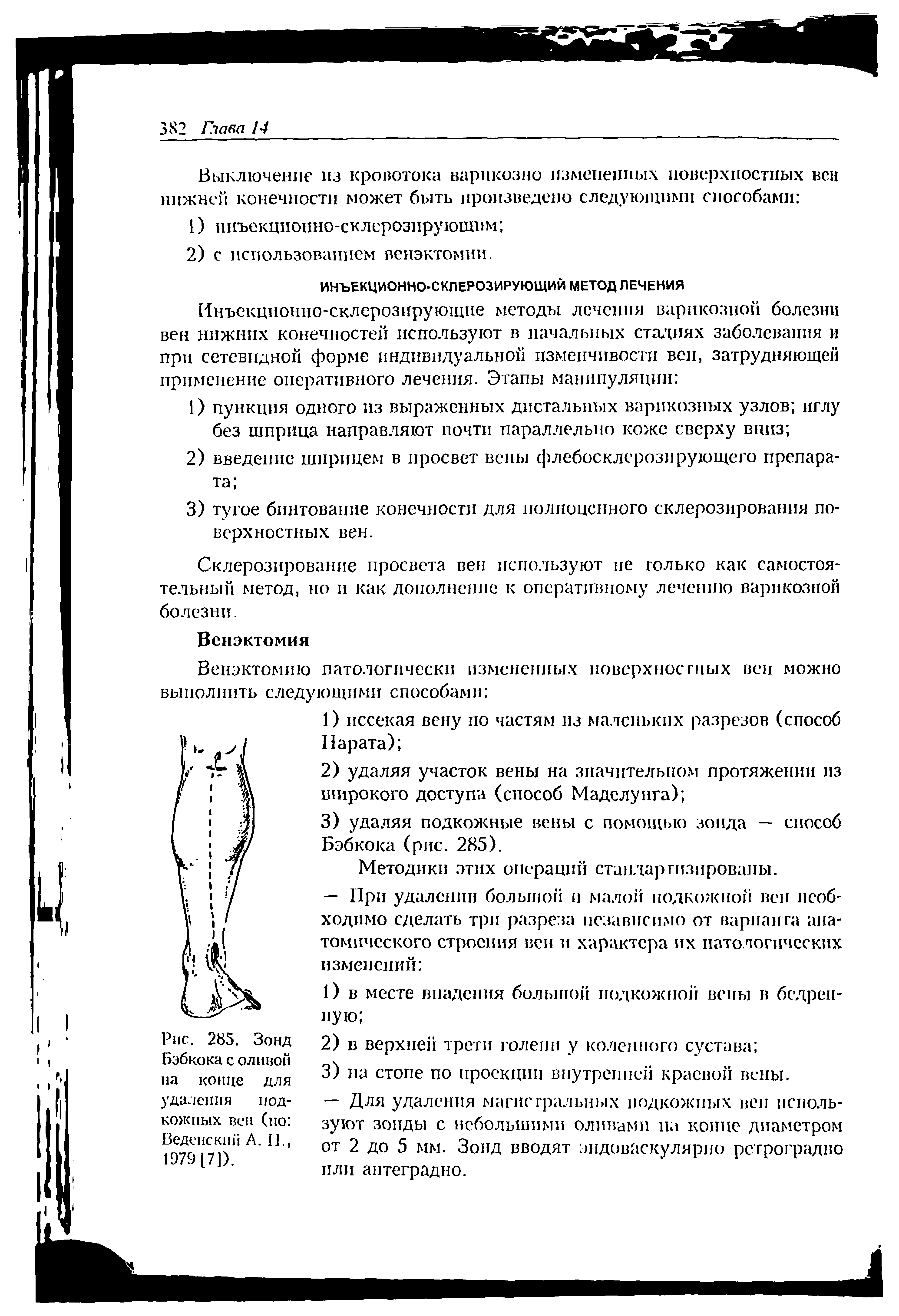 Рис. 285. Зонд Бэбкока с оливой на конце для удаления подкожных вен (по Веденский А. 11., 1979 [7]).